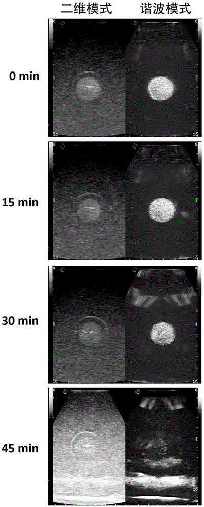 Simulator model used for simulating tumor ultrasonic radiography