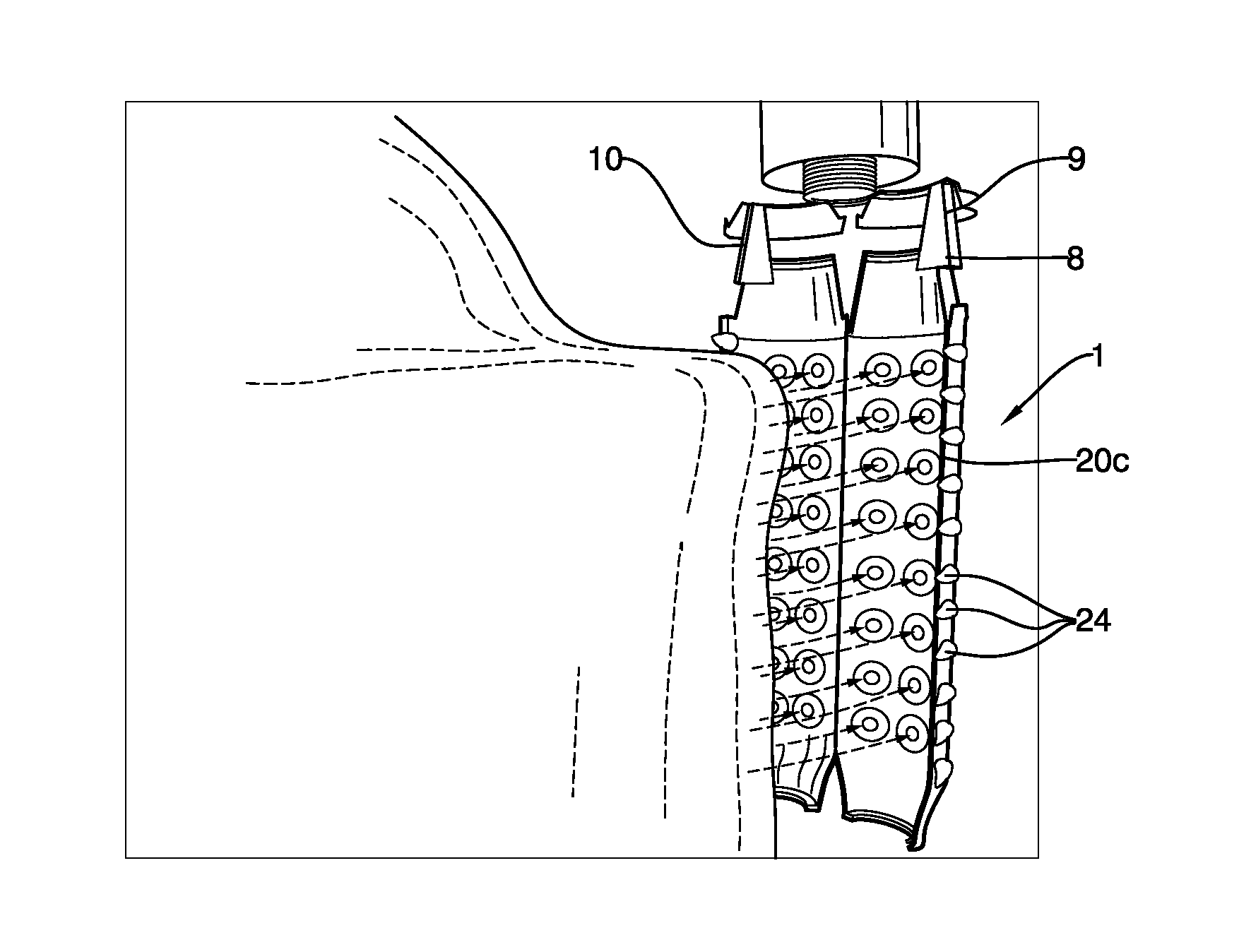 Endoscopic implantable device and method for the apposition of the stomach walls for reducing the stomach internal volume in a weight loss surgery procedure