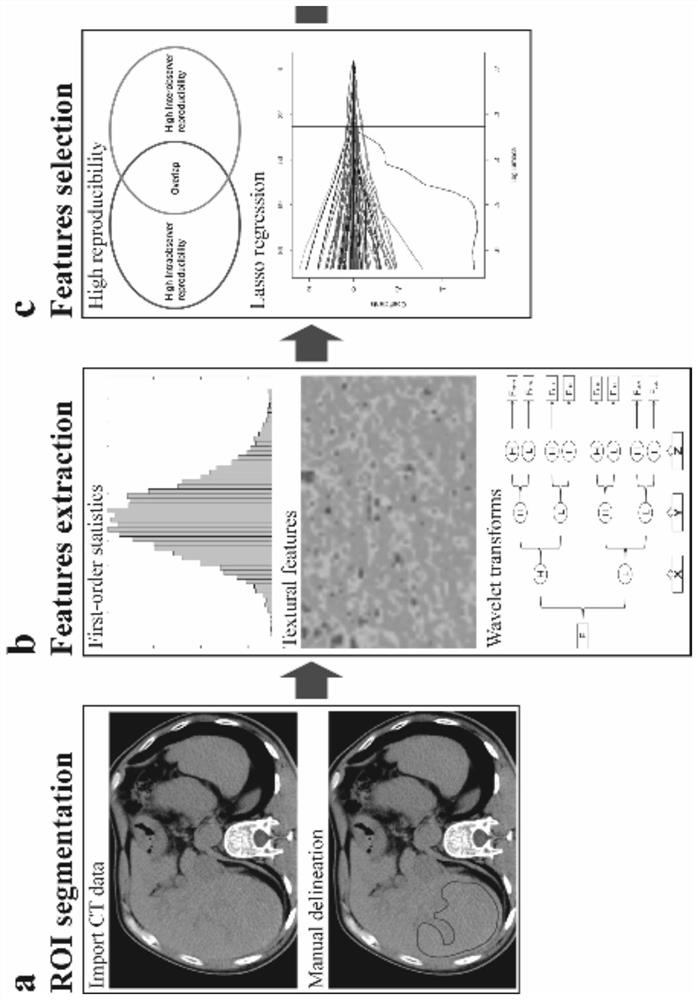 Image omics feature extraction and screening method of CT image for constructing chronic hepatitis B cirrhosis prediction model