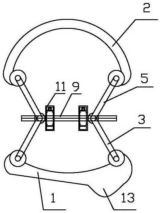 Surgical instrument for mandibular condyle