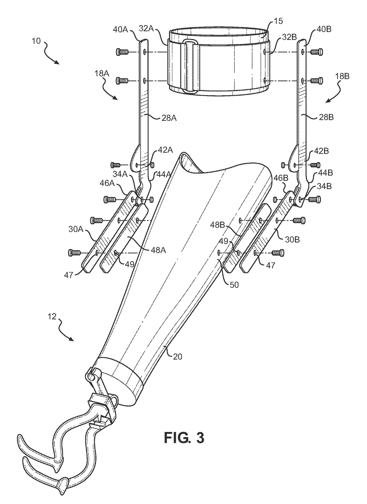 Harness for upper extremity below-elbow prosthesis