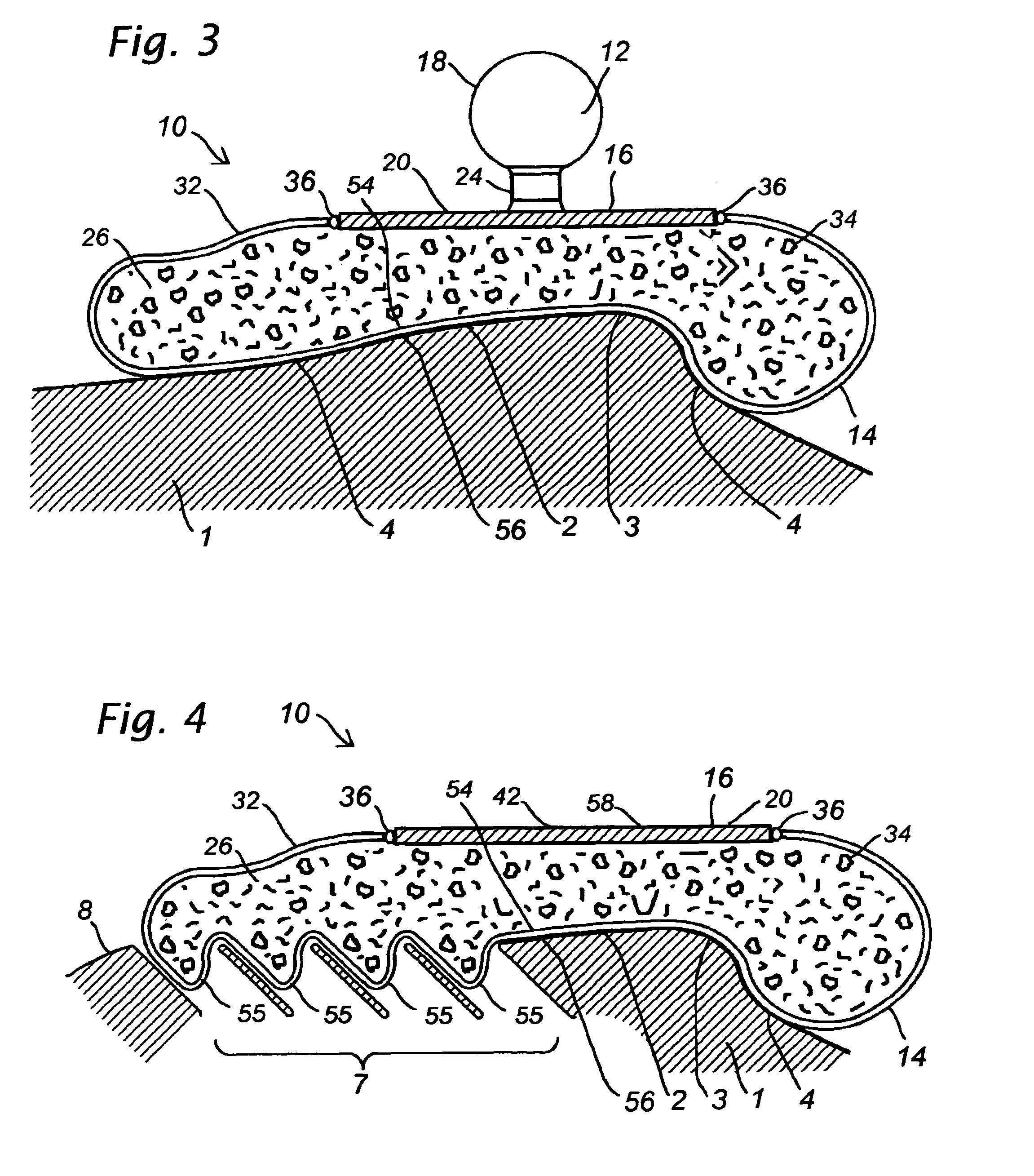 Adaptive mounting structure