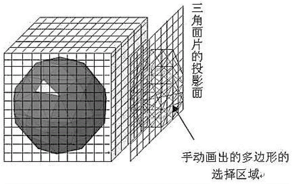 Method for Obtaining Volume of Interest in Four-Dimensional Cardiac Image