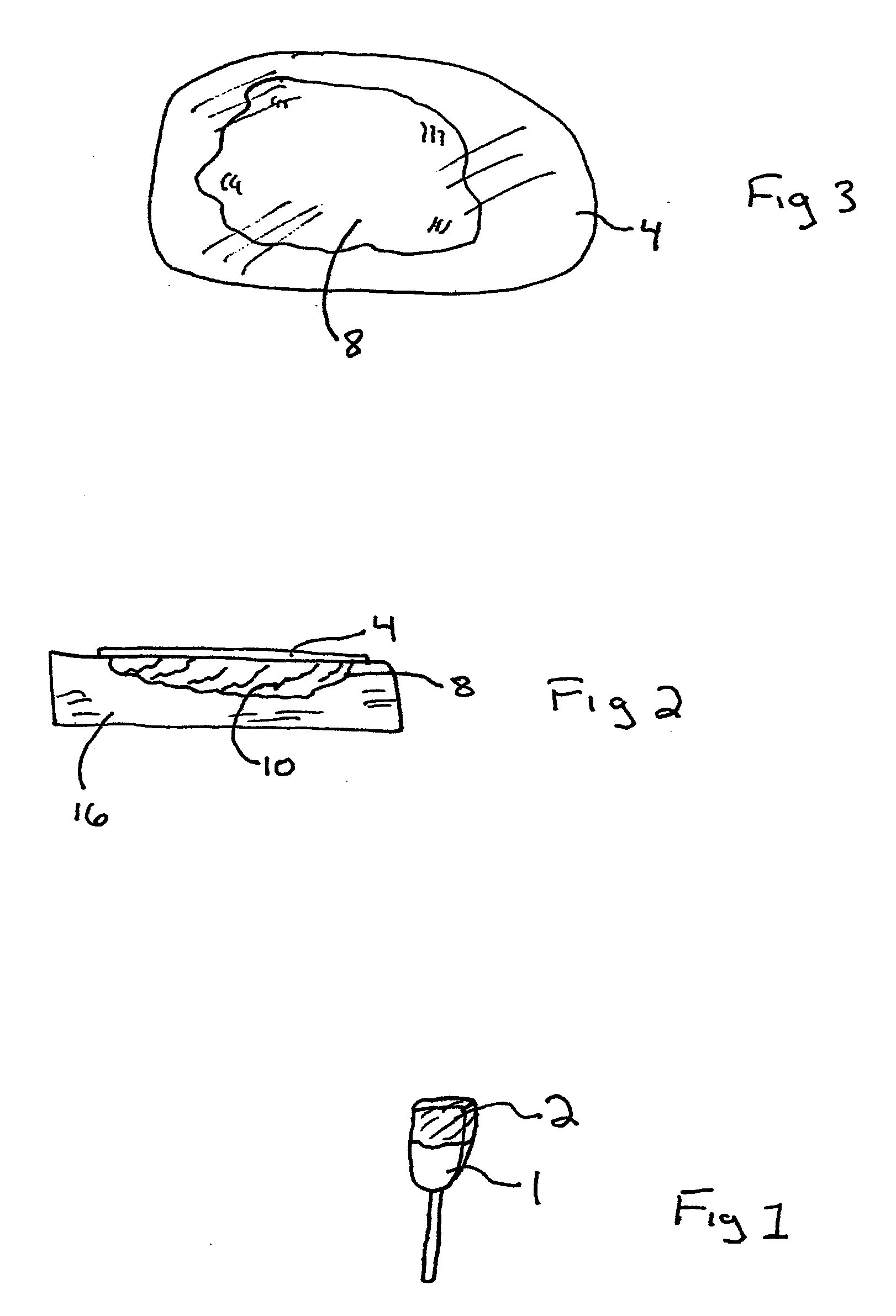 Noninvasive method of ultrasound wound evaluation