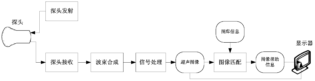 Ultrasound-assisted scanning method and system