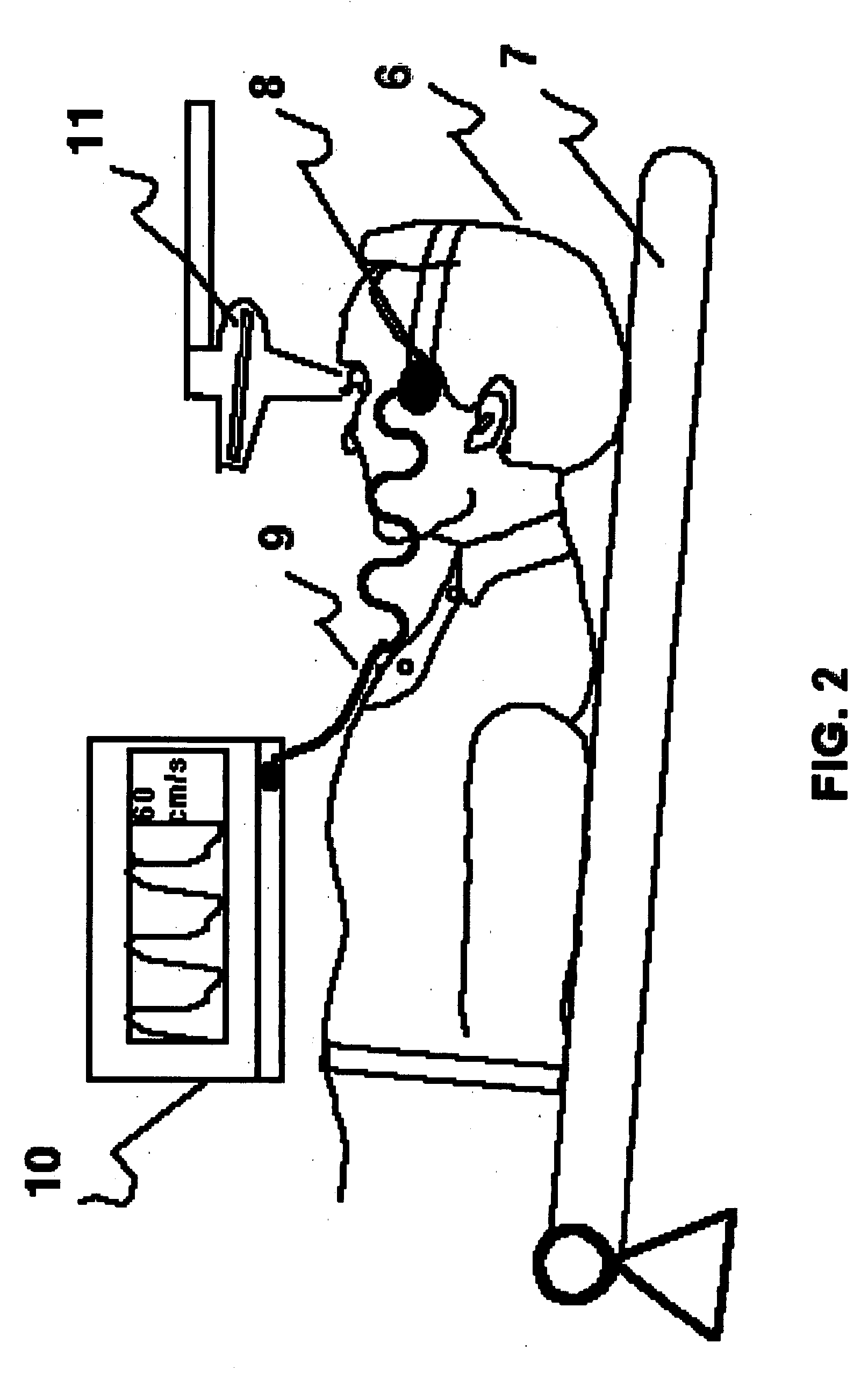 Method for inducing and monitoring long-term potentiation and long-term depression using transcranial doppler ultrasound device in head-down bed rest