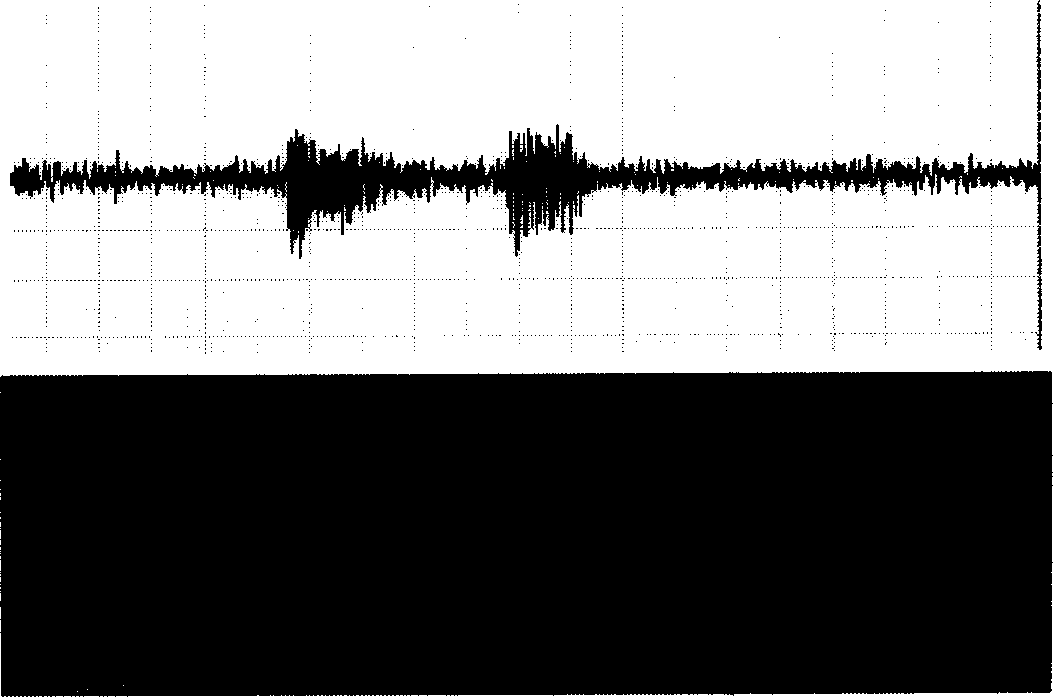 Voice end detection method based on energy and harmonic