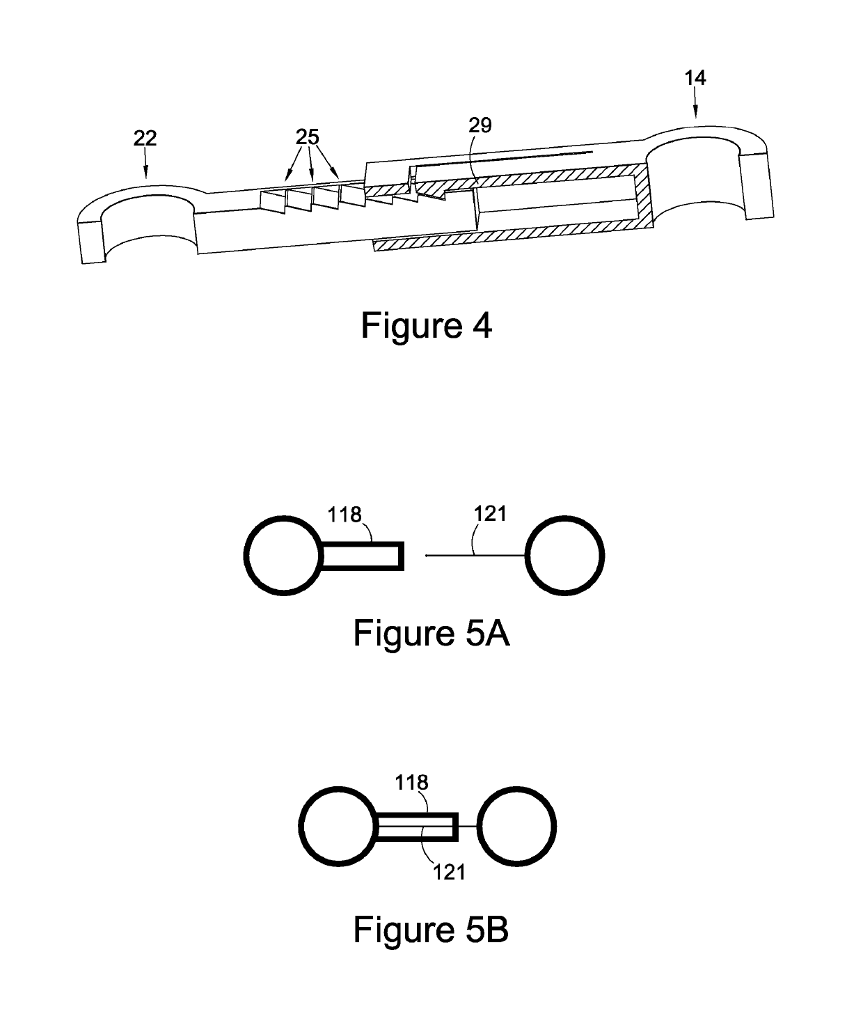 Bone ties and staples for use in orthopaedic surgery