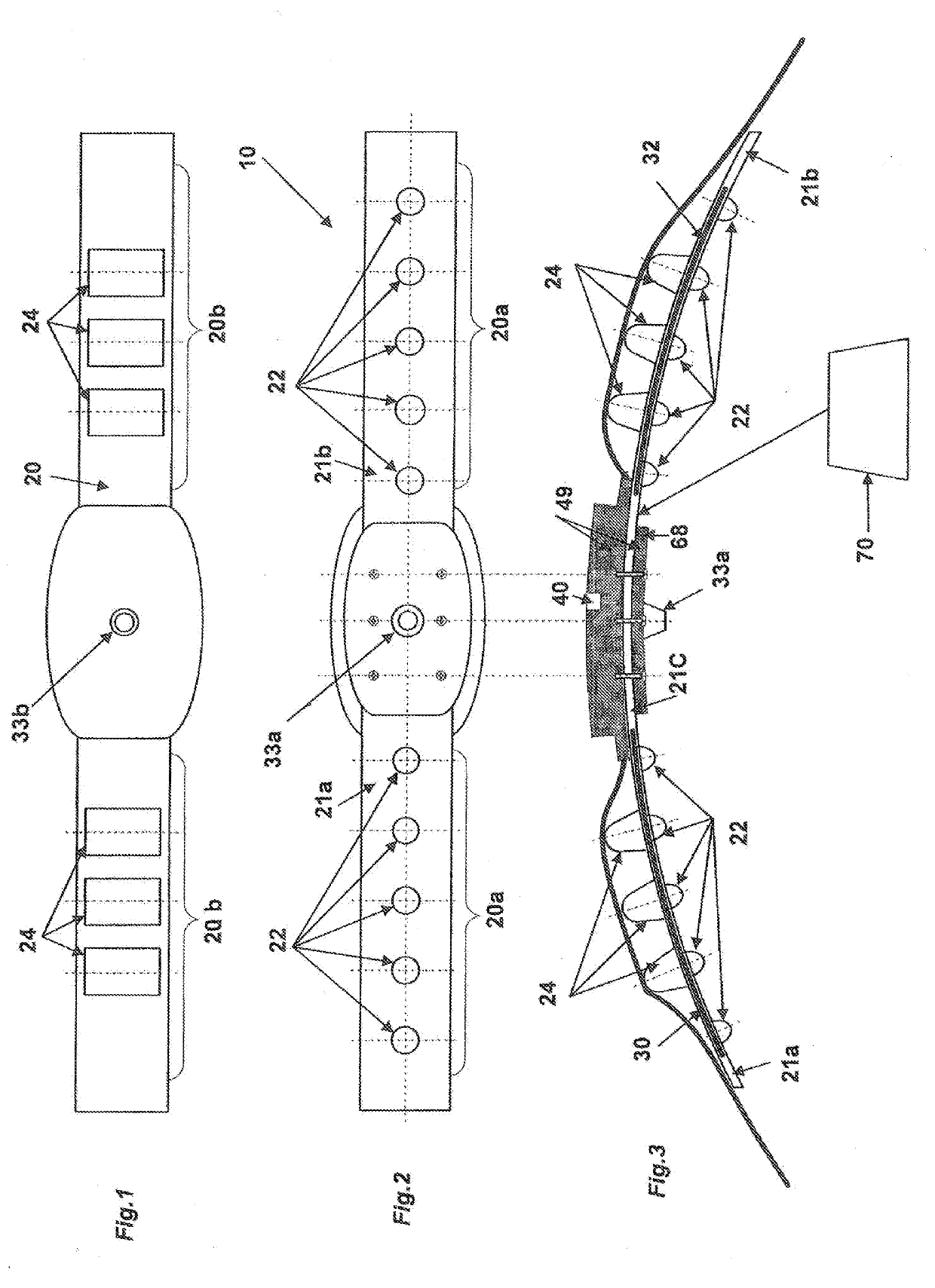 Acoustically Enhanced Pet Animal Collar for Health & Vital Signs Monitoring, Alert and Diagnosis