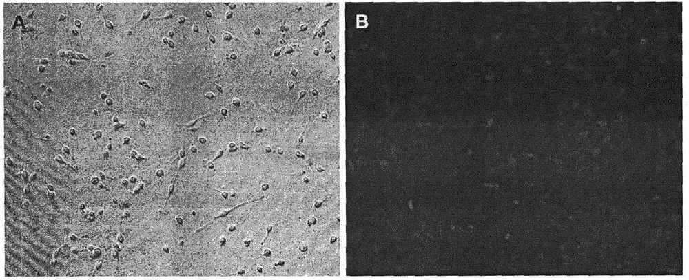 Preparation method of human oligodendrocyte precursor cell inhibiting nerve secondary injury, kit and application thereof