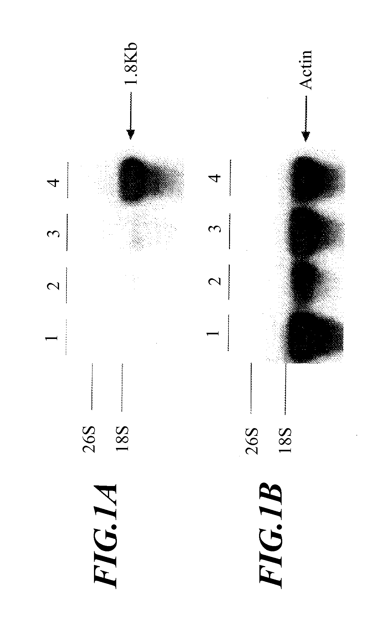 Anther-specific expression promoter in plant and application thereof