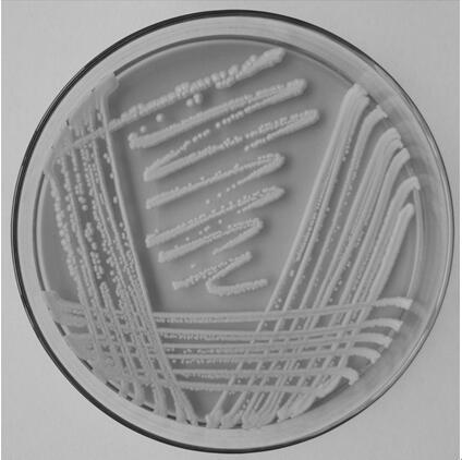 Application of wickerhamomyces anomalus 1027JM-2 in soy sauce brewing