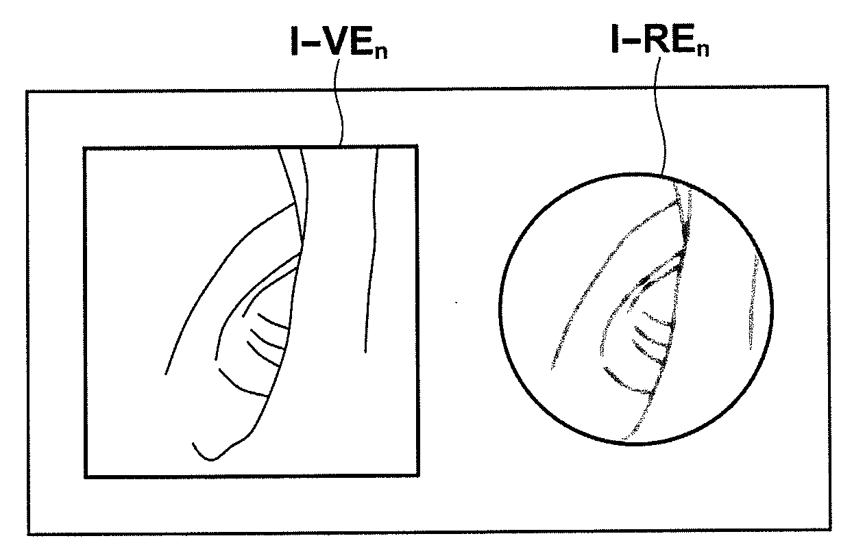 Medical image processing apparatus method and program