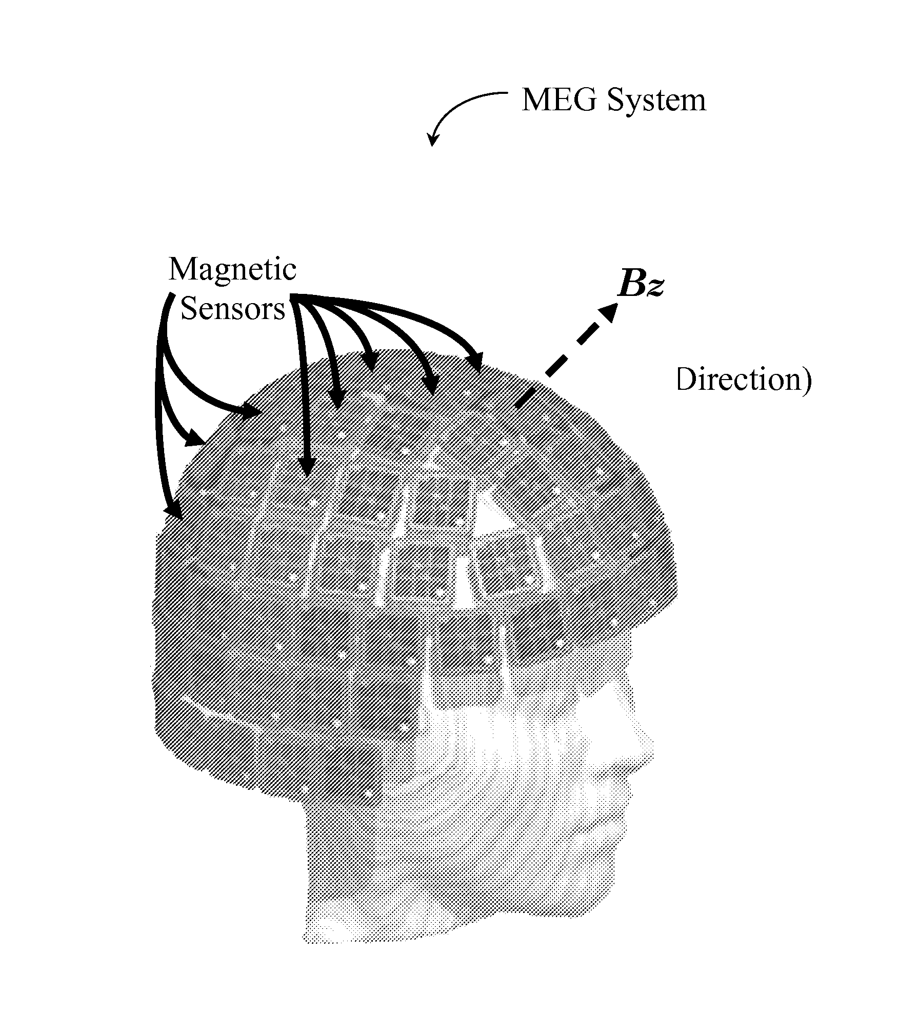 2D Dipole Localization Using Absolute Value of MCG Measurements