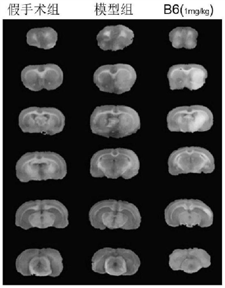 Proline derivatives and their application in the preparation of drugs for treating cardiovascular and cerebrovascular diseases