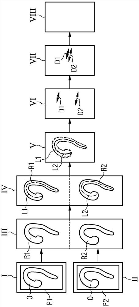 Method and device for automatic determination of the change of a hollow organ