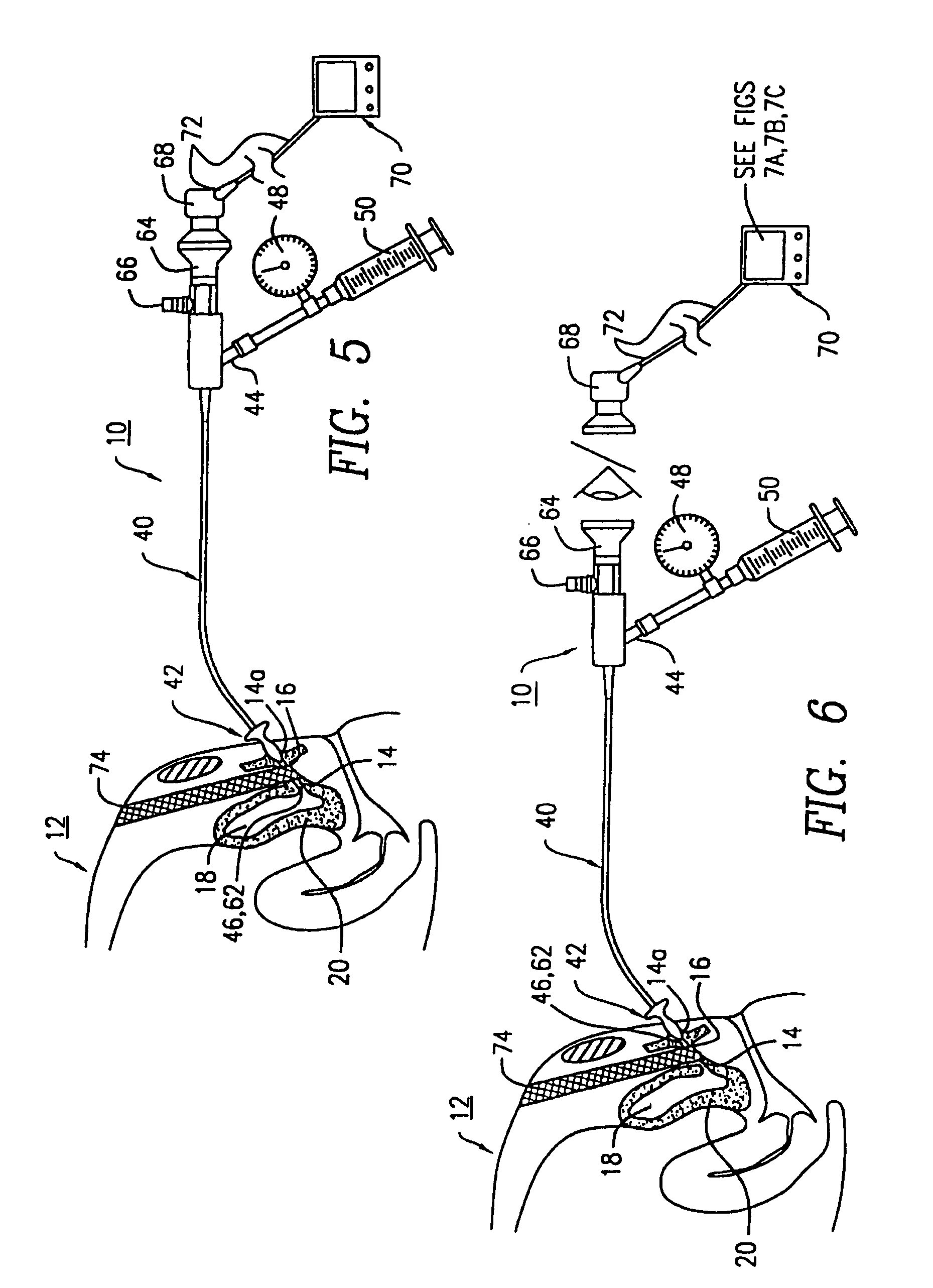 Apparatus and method for the measurement of the resistance of the urethral sphincter