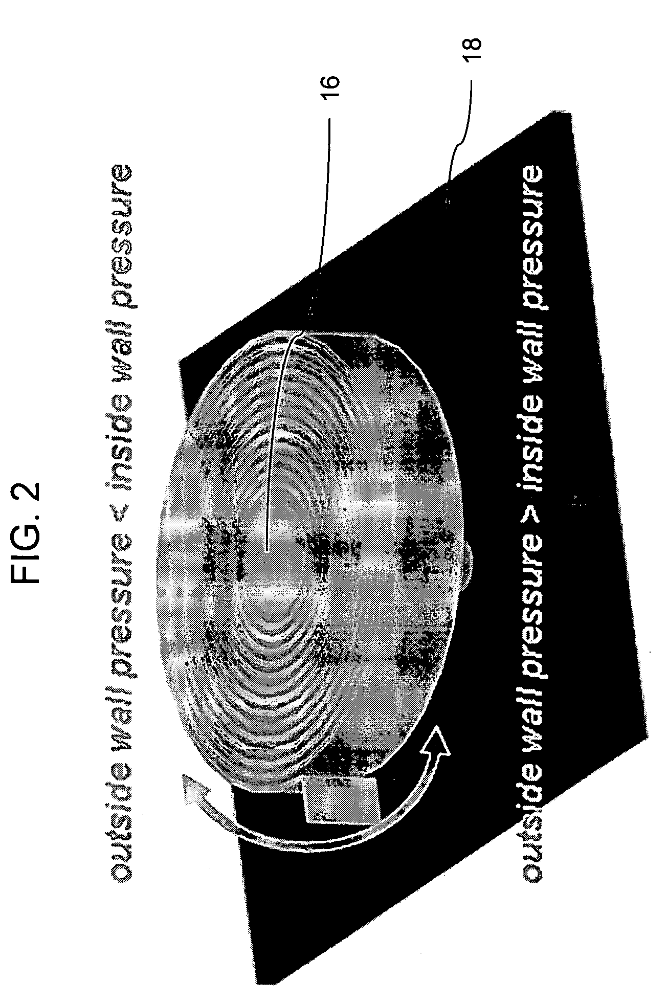 Implantable mechanical pressure sensor and method of manufacturing the same