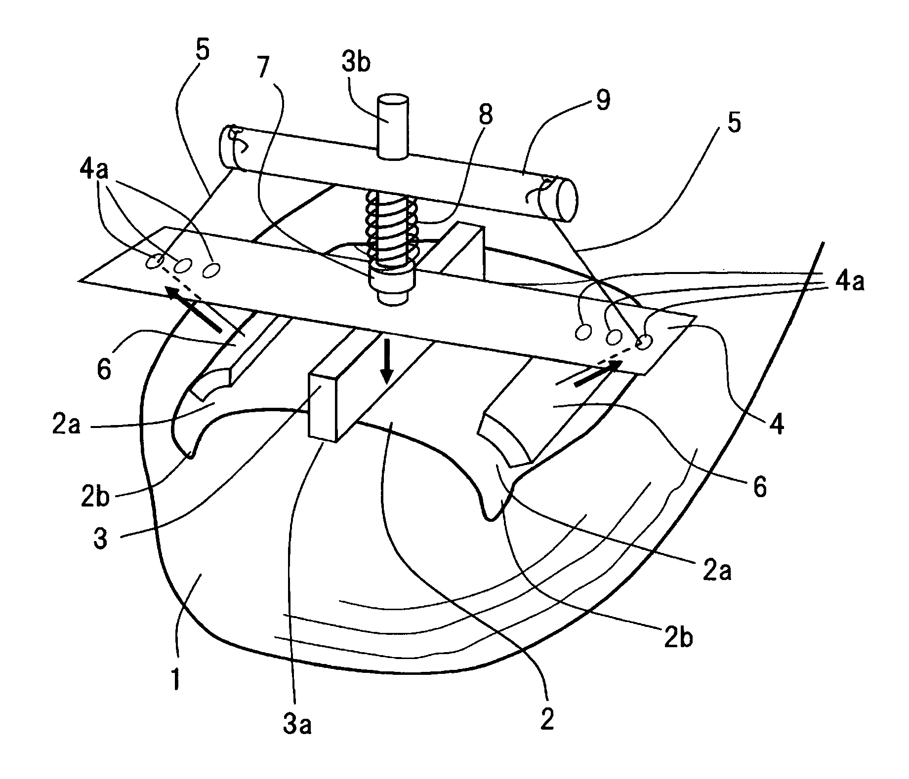 Apparatus for correcting an ingrown nail