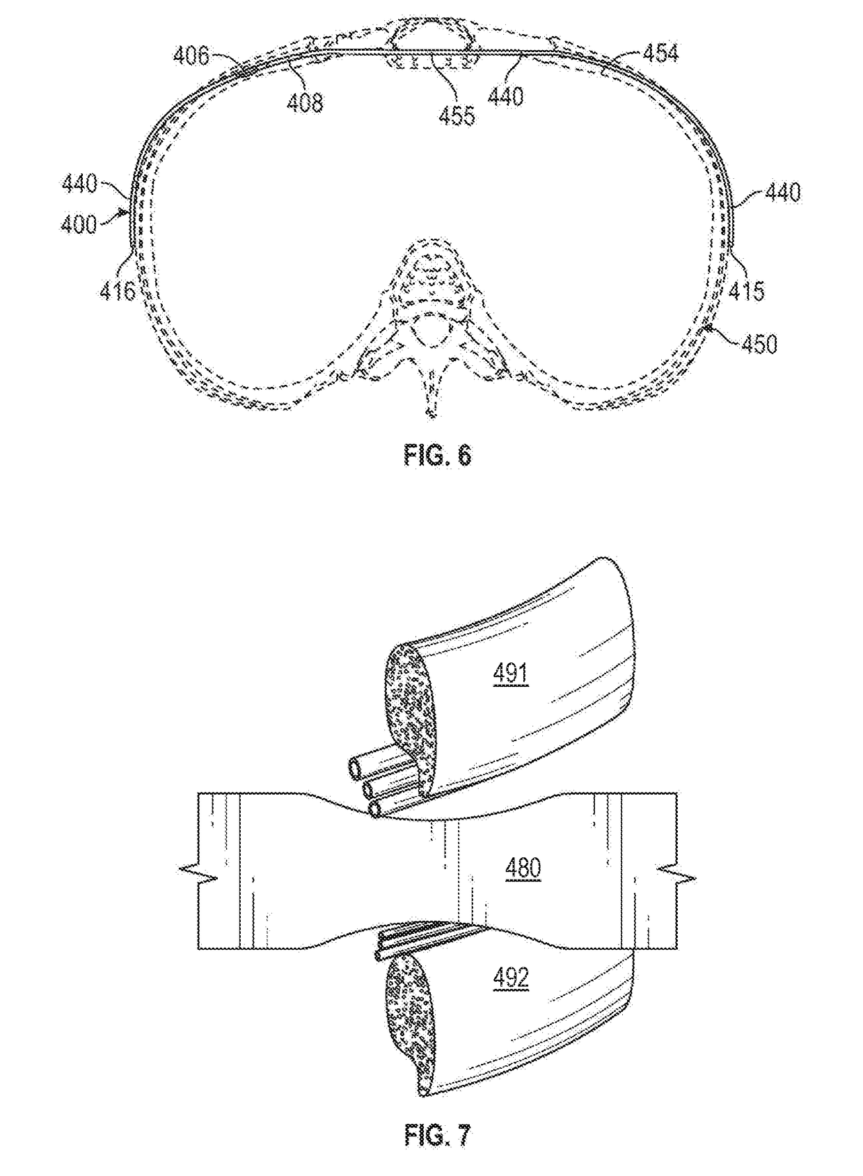 Apparatus and Methods For Treating Pectus Excavatum