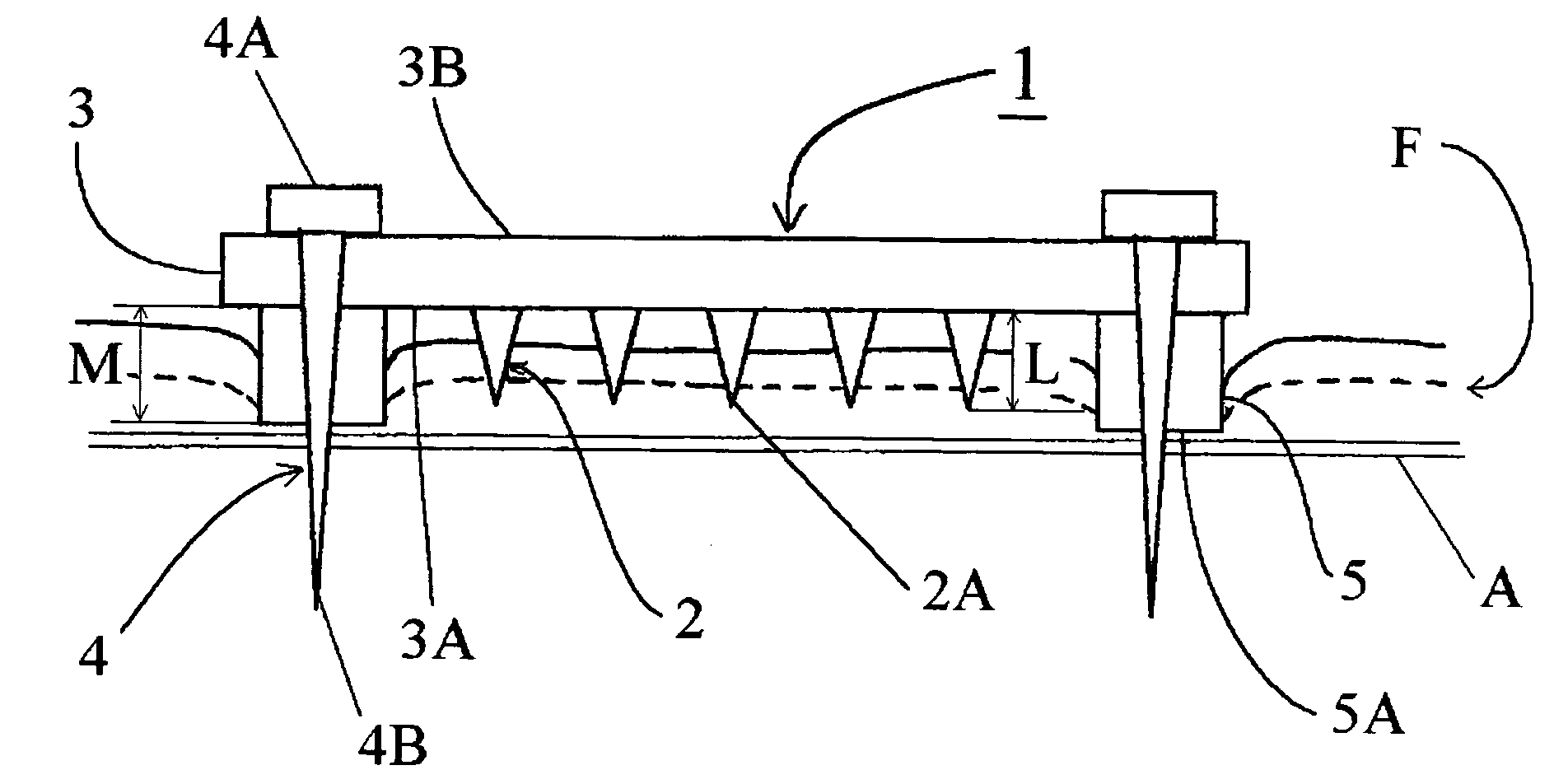 Electrode member for retinal stimulation, and artificial retinal device using the electrode member