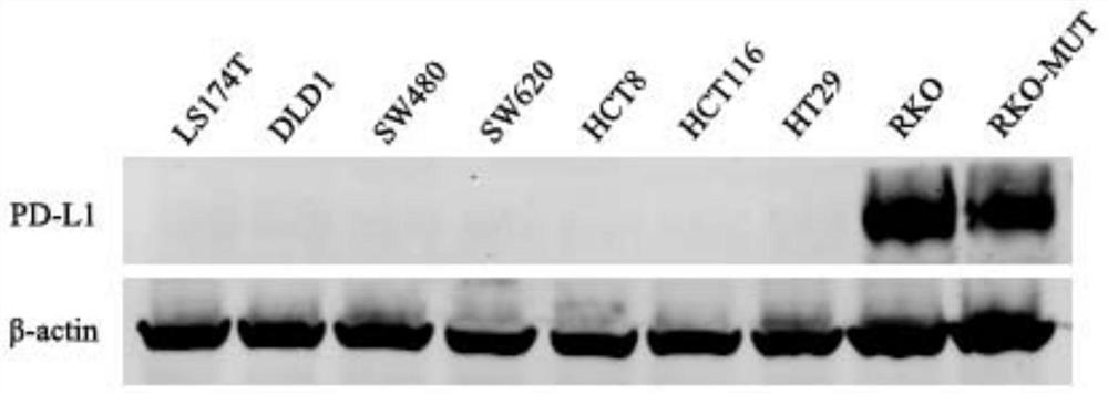 Use of PD-L1 spliceosome B as a marker to guide the dosing of anti-PD-L1/PD1 immunotherapy