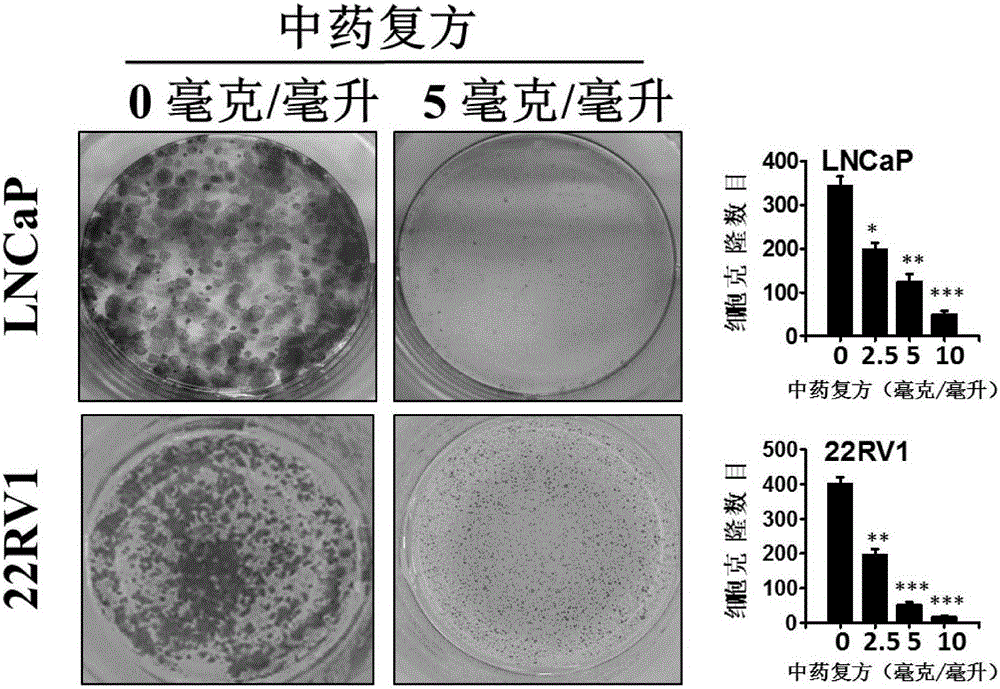 Compound traditional Chinese medicine composition and application thereof to resistance to prostate cancer