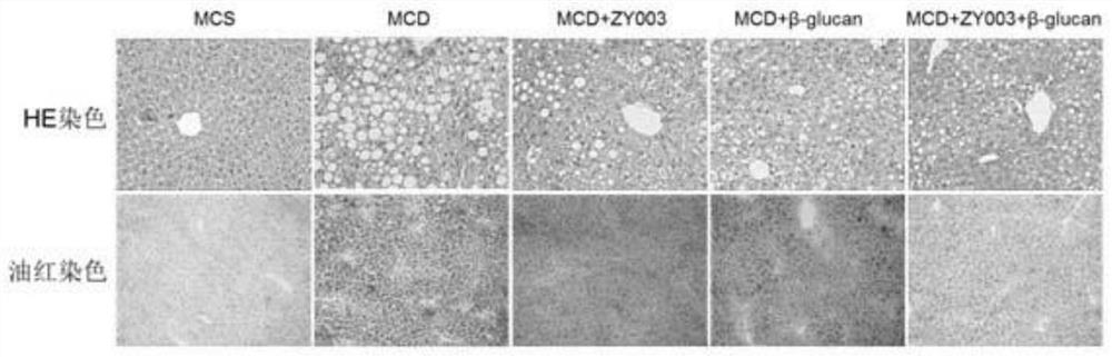 Composition for preventing, reducing and/or alleviating non-alcoholic steatohepatitis and its application