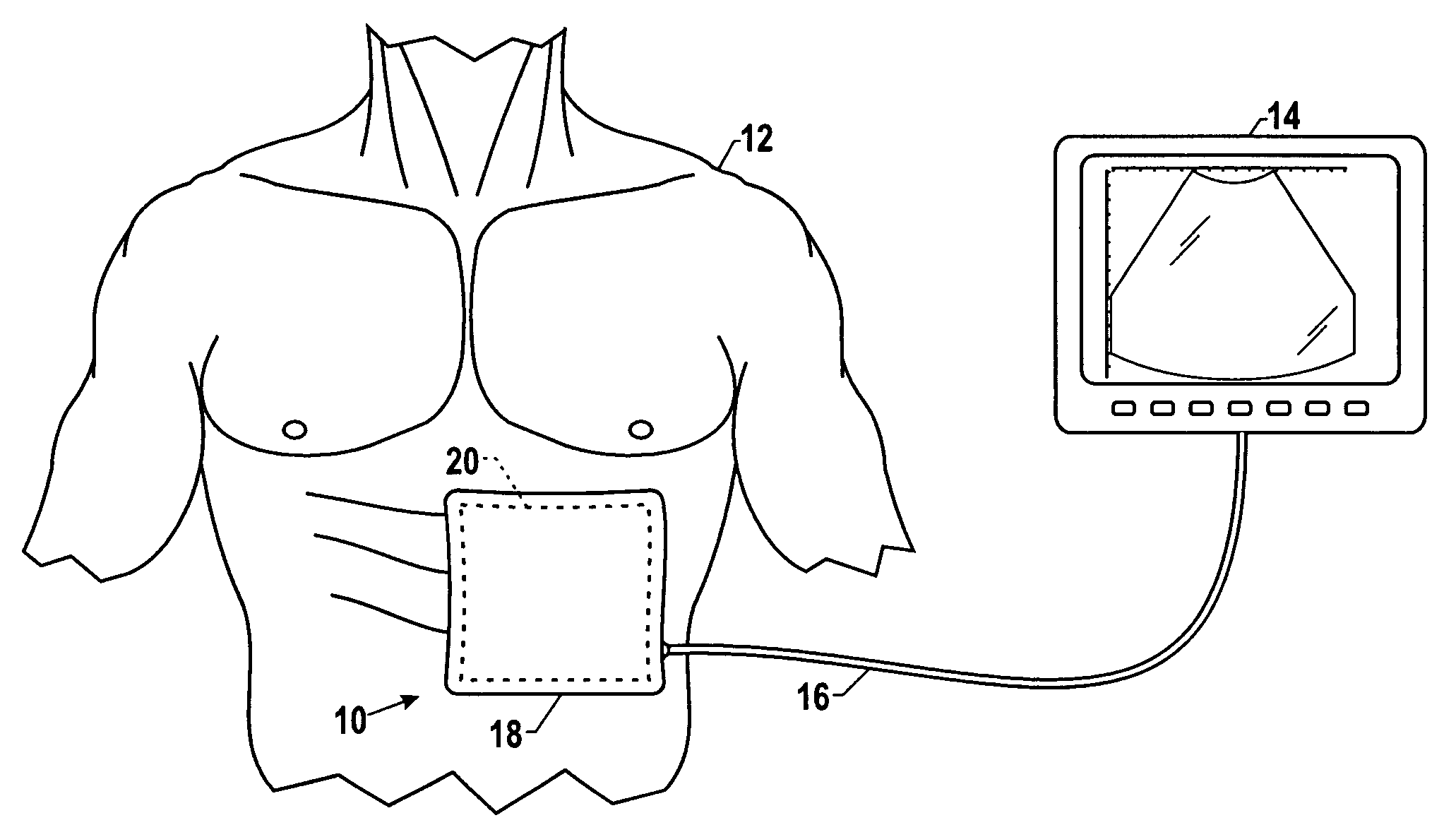 Systems and methods for operating a two-dimensional transducer array