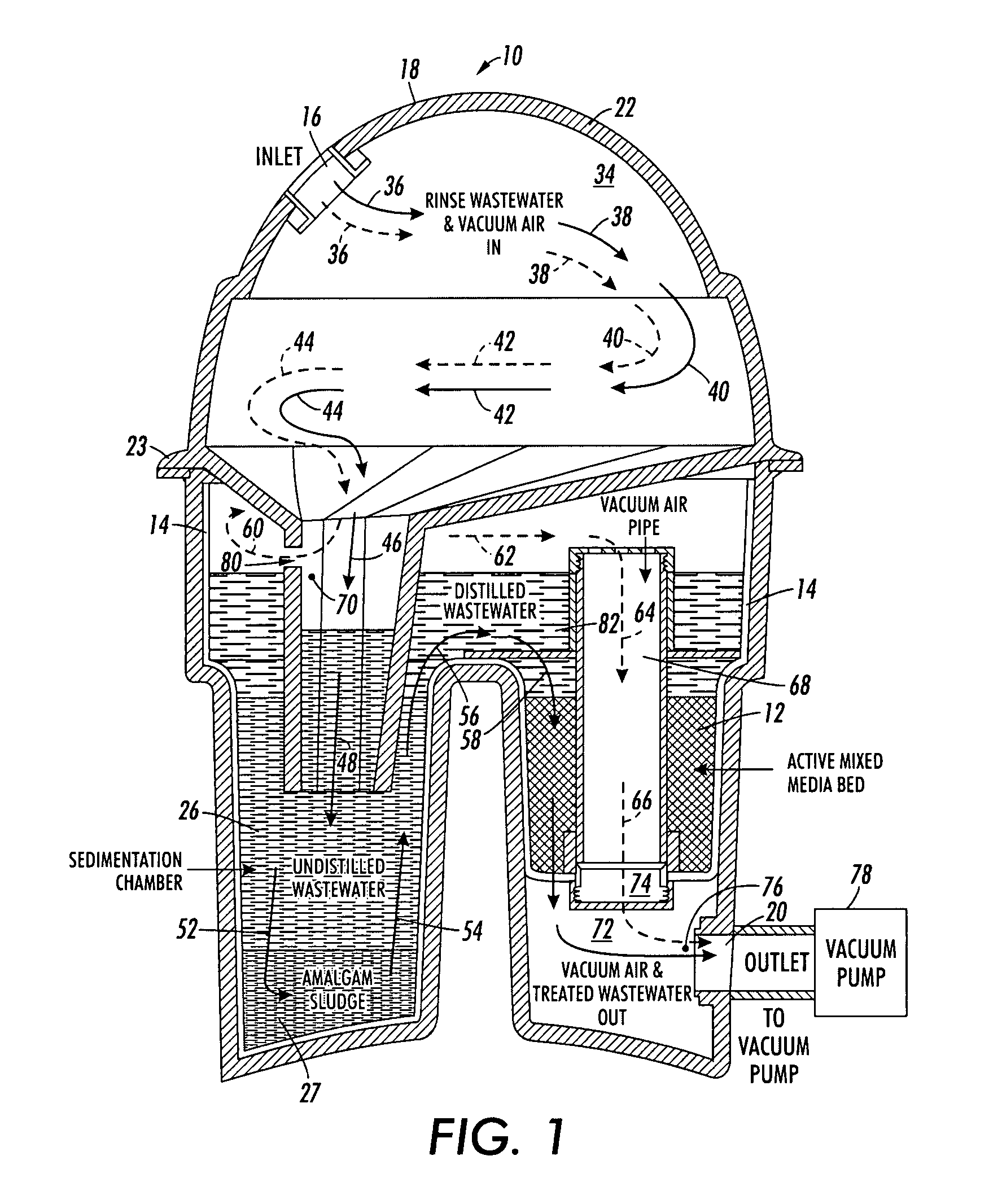 Amalgam separator