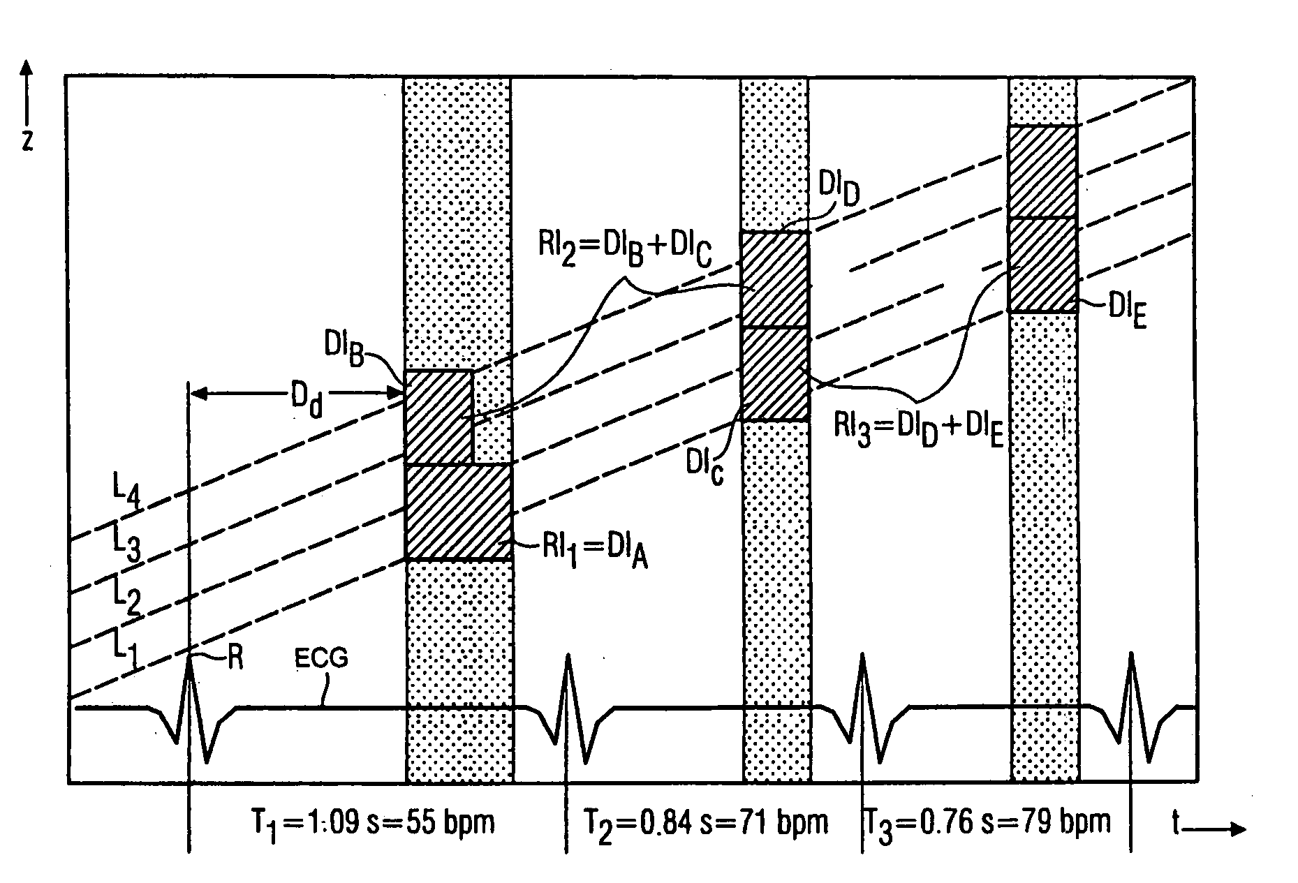 Method for examining a body region of an examination object, which body region performs a periodic movement, and CT apparatus for carrying out such a method