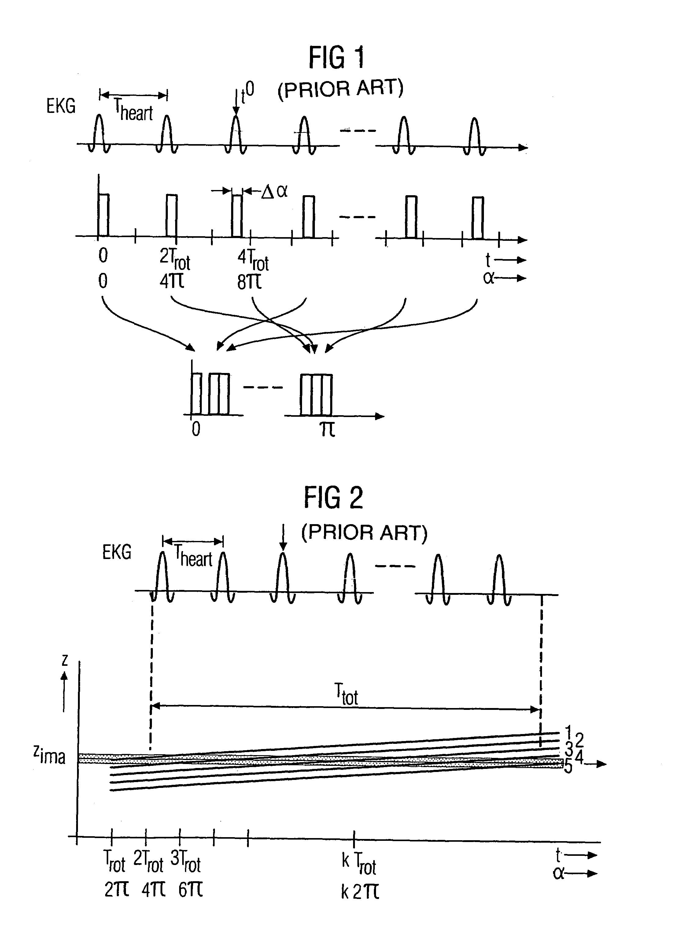 Method for examining a body region of an examination object, which body region performs a periodic movement, and CT apparatus for carrying out such a method