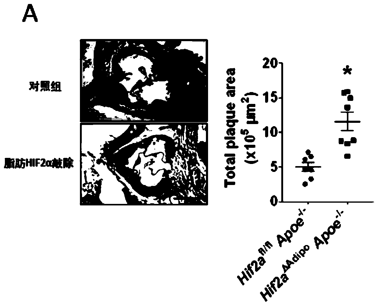 Application of HIF2alpha agonist and ACER2 agonist in preparation of medicine for treating atherosclerosis