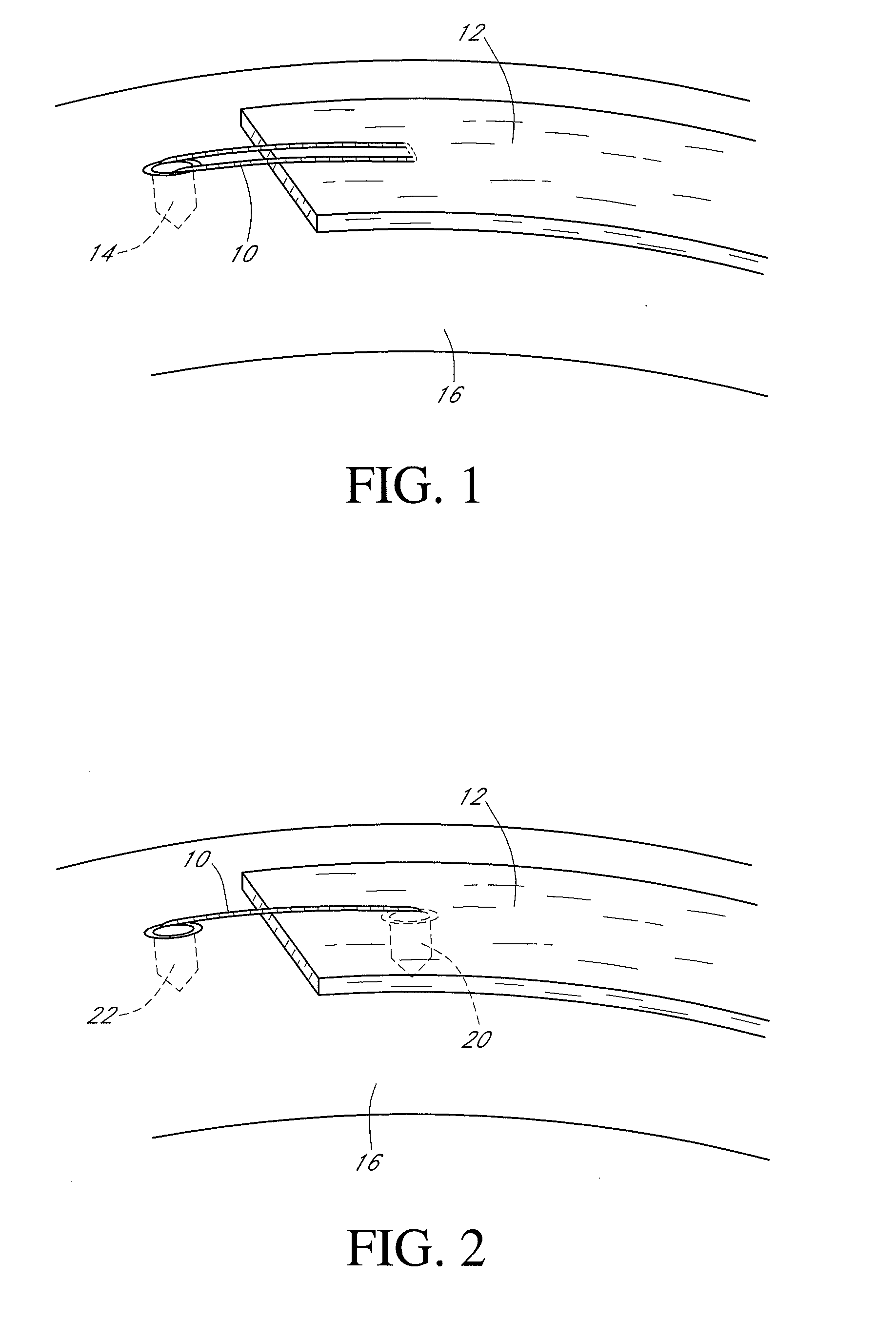 System and method for attaching soft tissue to bone