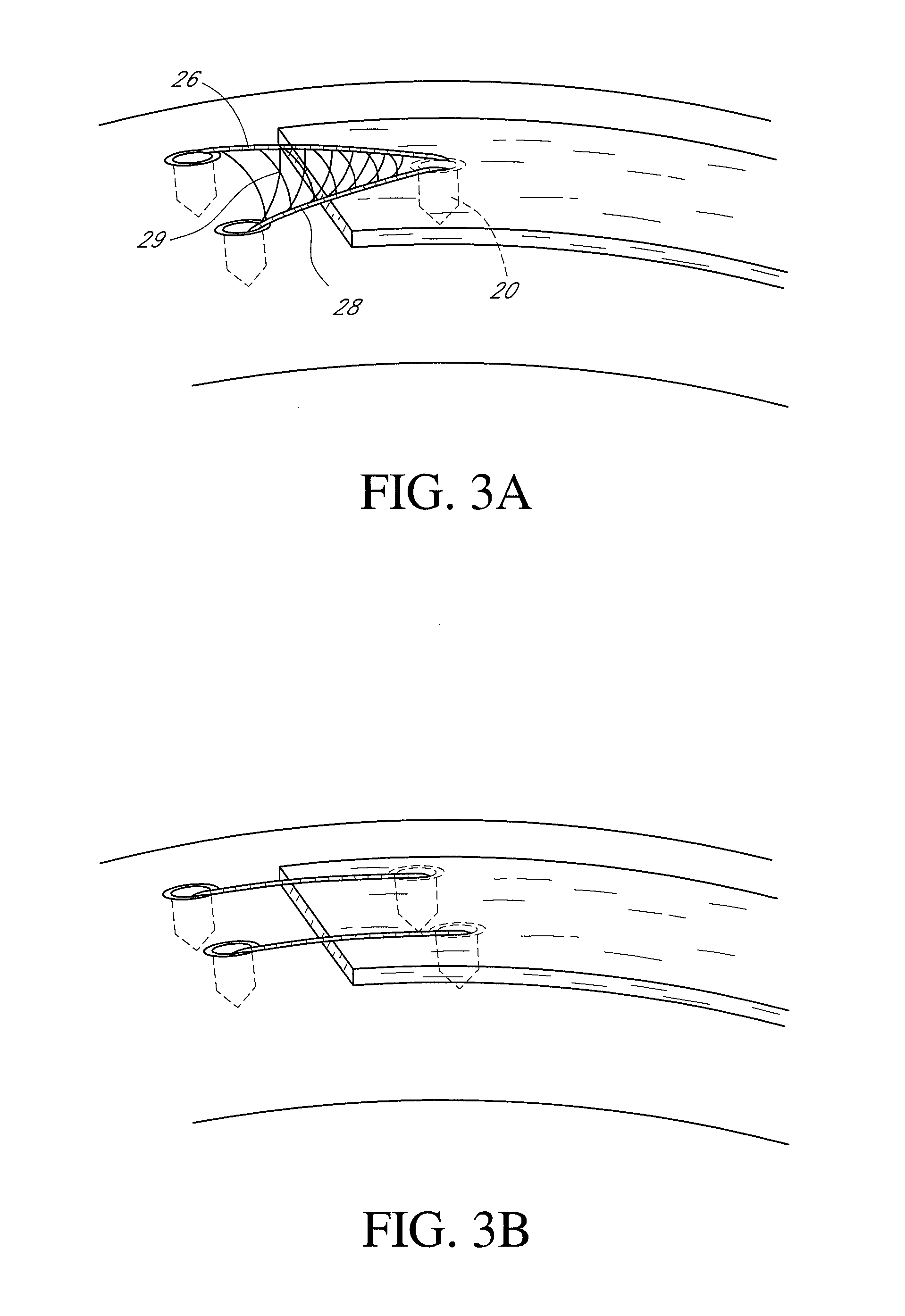 System and method for attaching soft tissue to bone