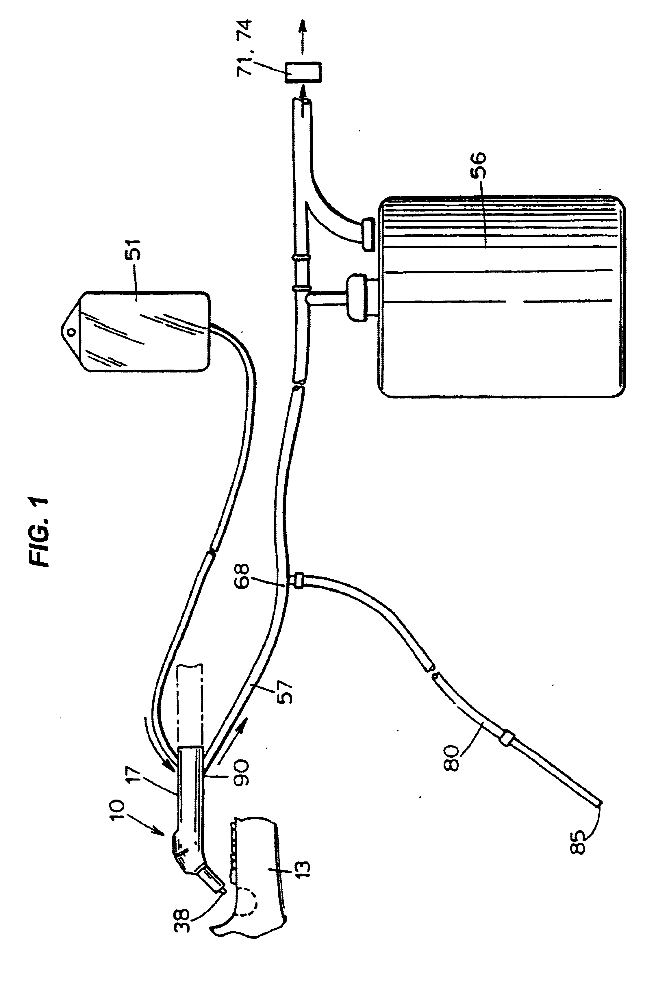 Method and apparatus for extracting bone marrow