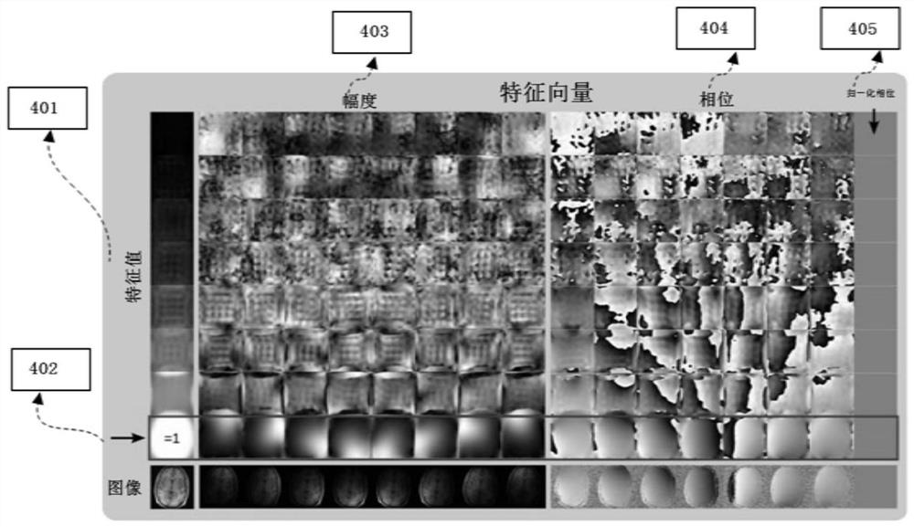 A MRI Reconstruction Method Based on Deep Learning and Convex Set Projection