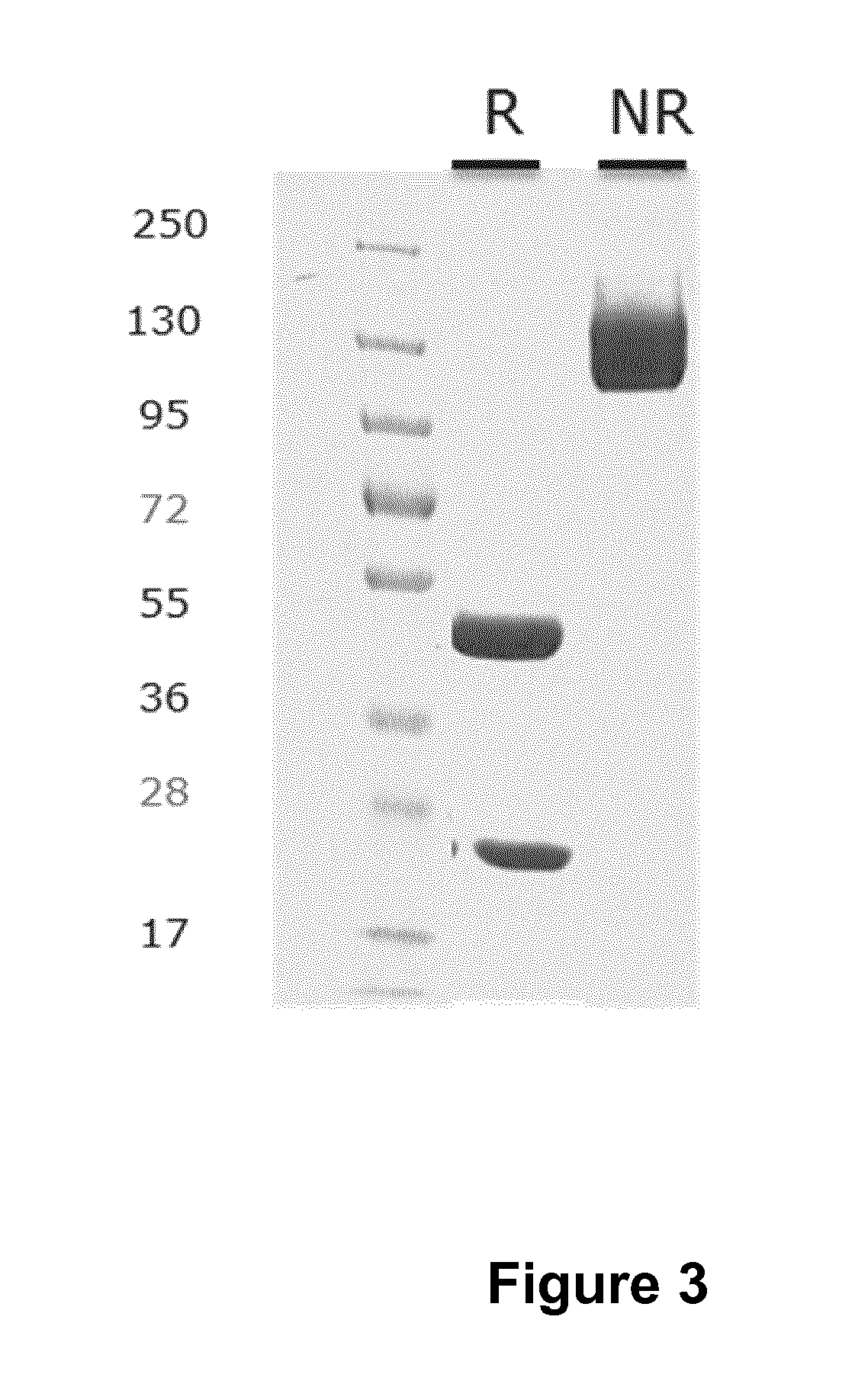 Anitbodies That Bind Urokinase Plasminogen Activator