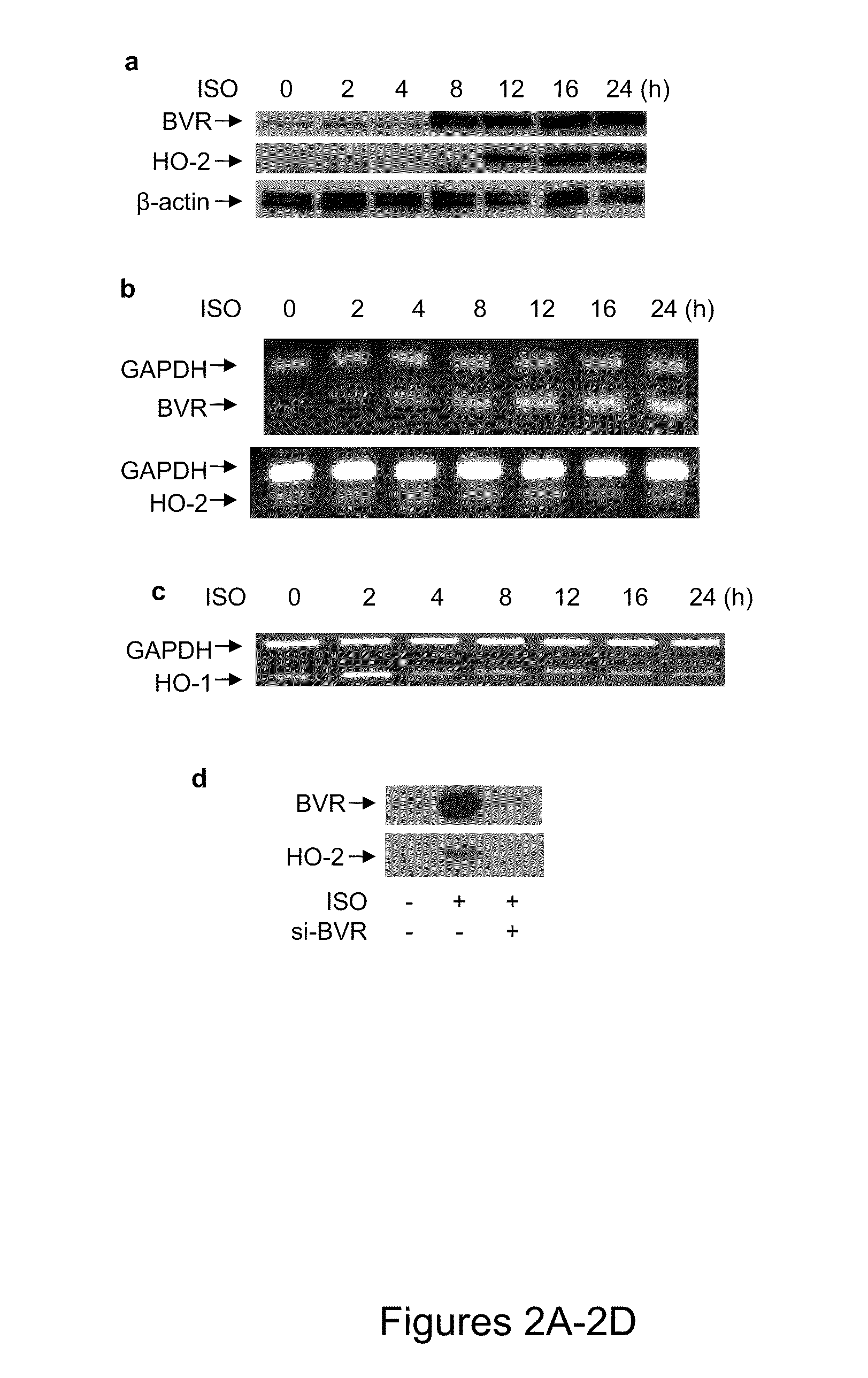 Use of biliverdin reductase (BVR) and bvr peptide fragments to treat coronary disorders