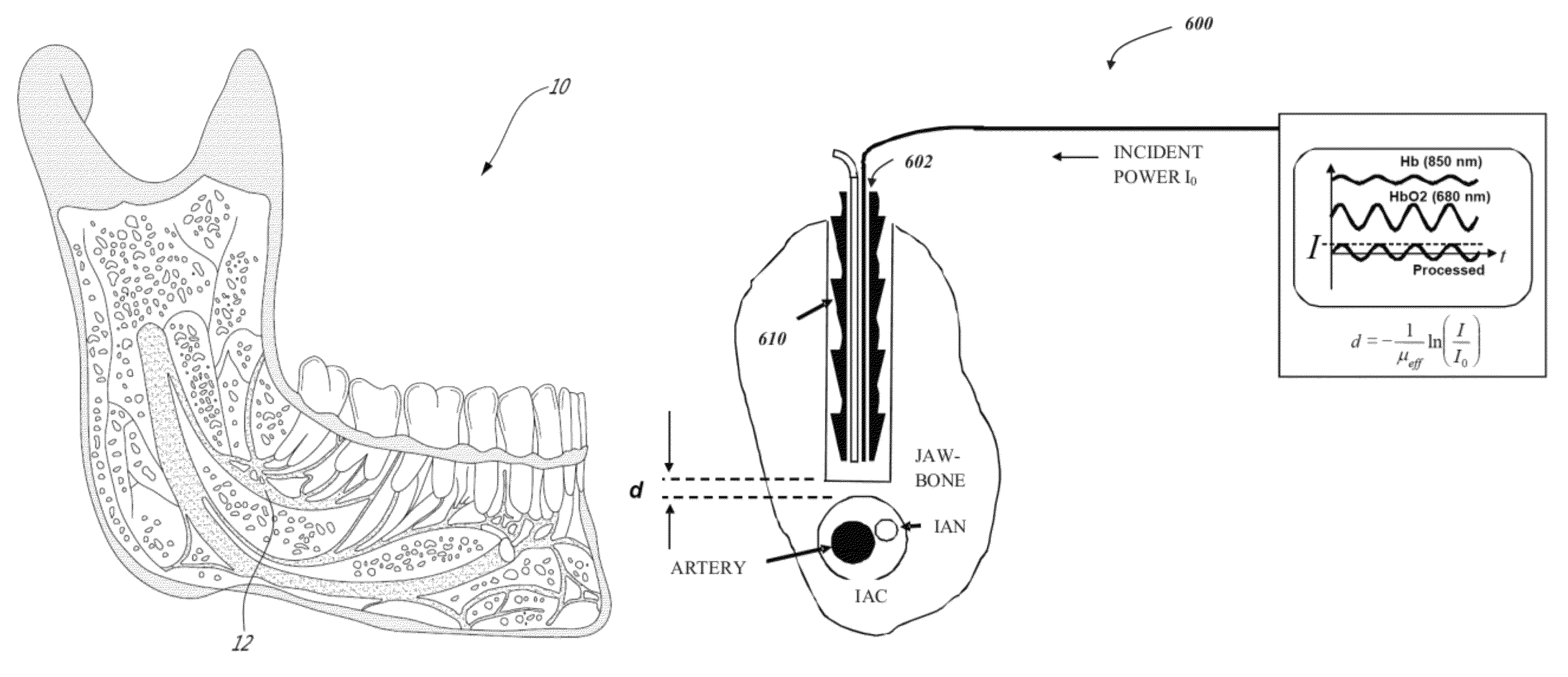 Method and system for optically evaluating proximity to the inferior alveolar nerve in situ