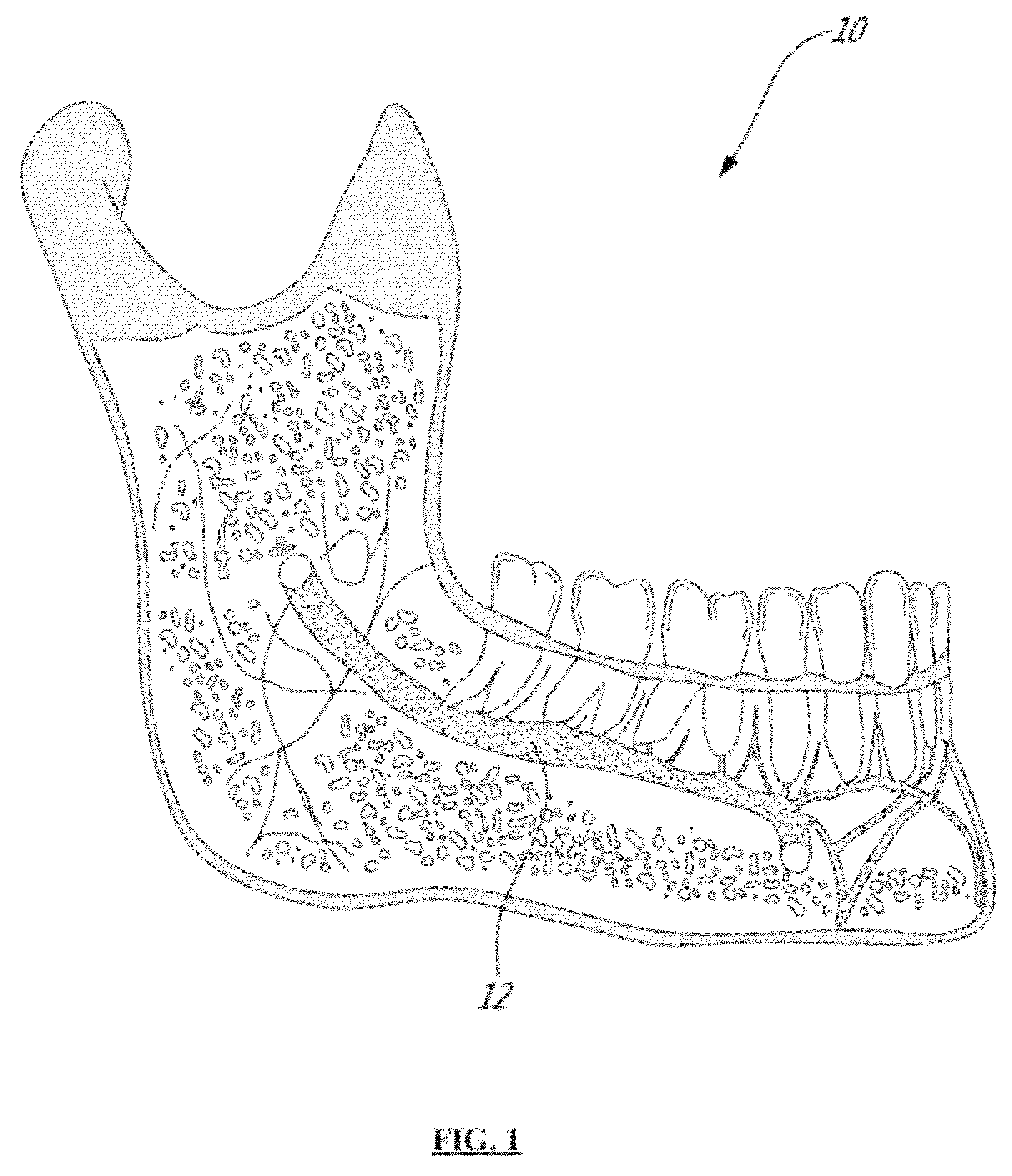 Method and system for optically evaluating proximity to the inferior alveolar nerve in situ