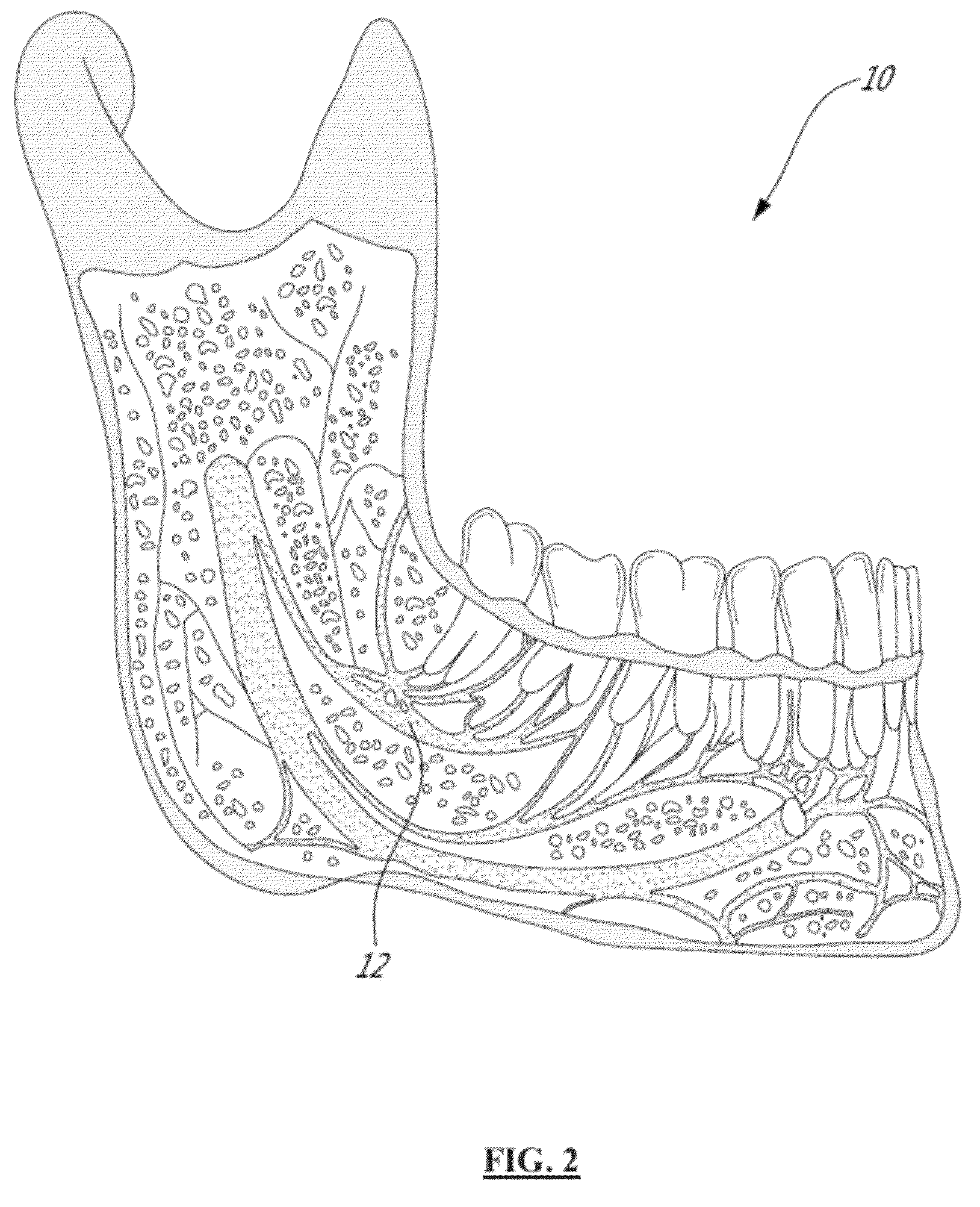 Method and system for optically evaluating proximity to the inferior alveolar nerve in situ