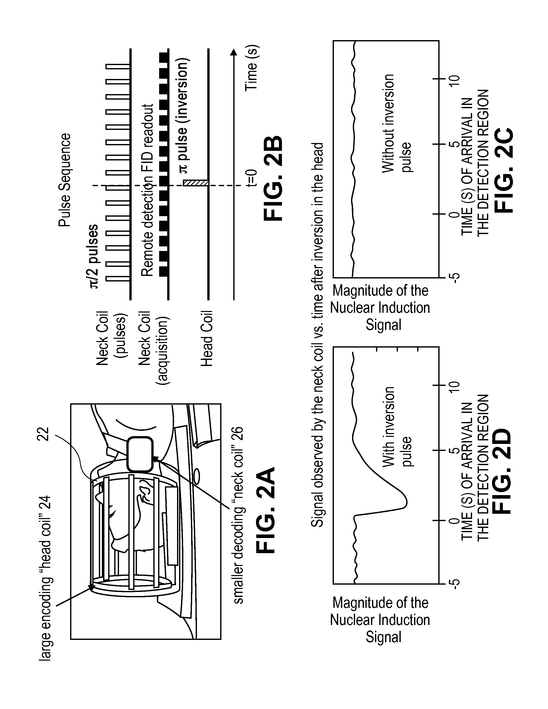 Magnetic resonance imaging of living systems by remote detection