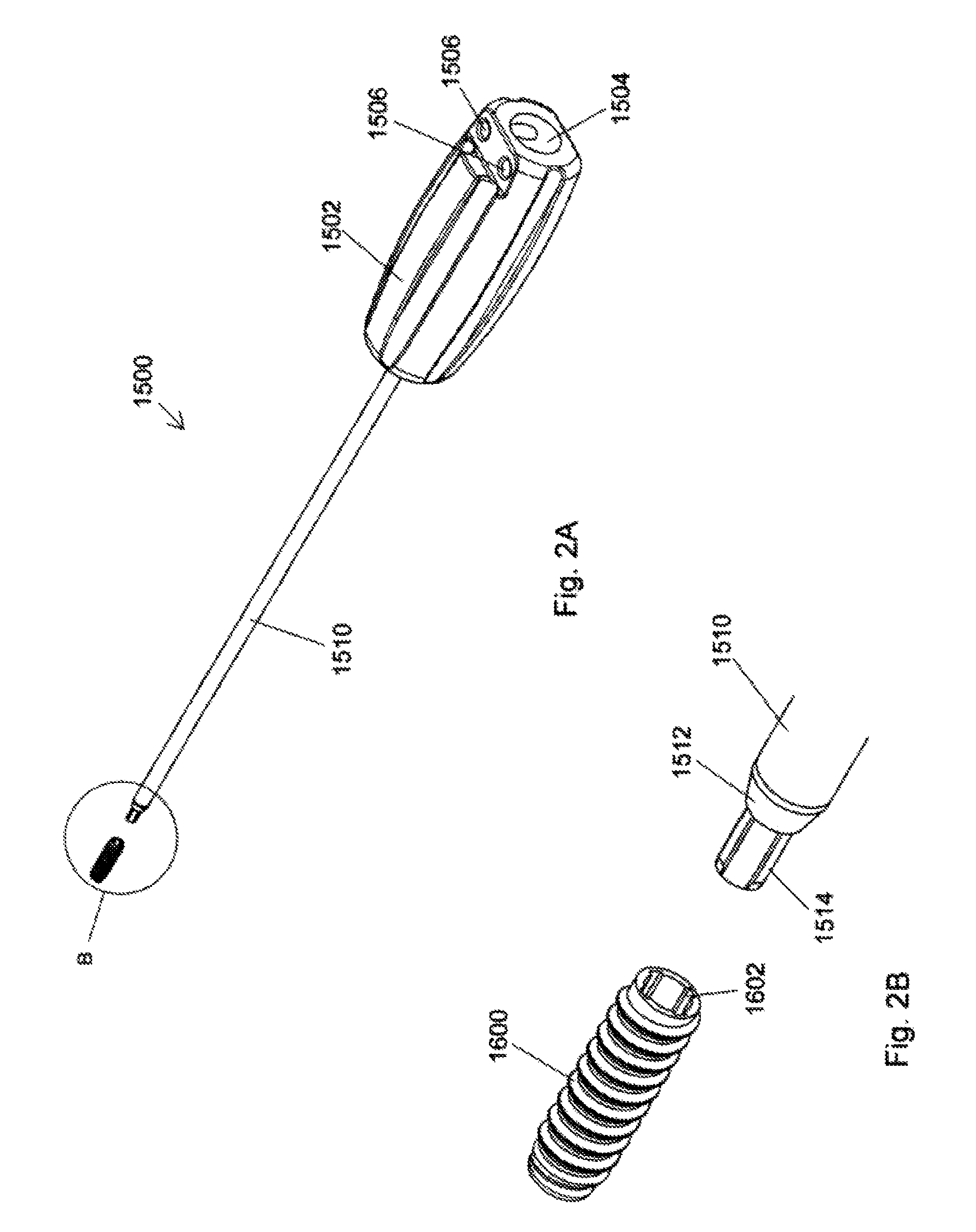 Implant placement systems, devices and methods