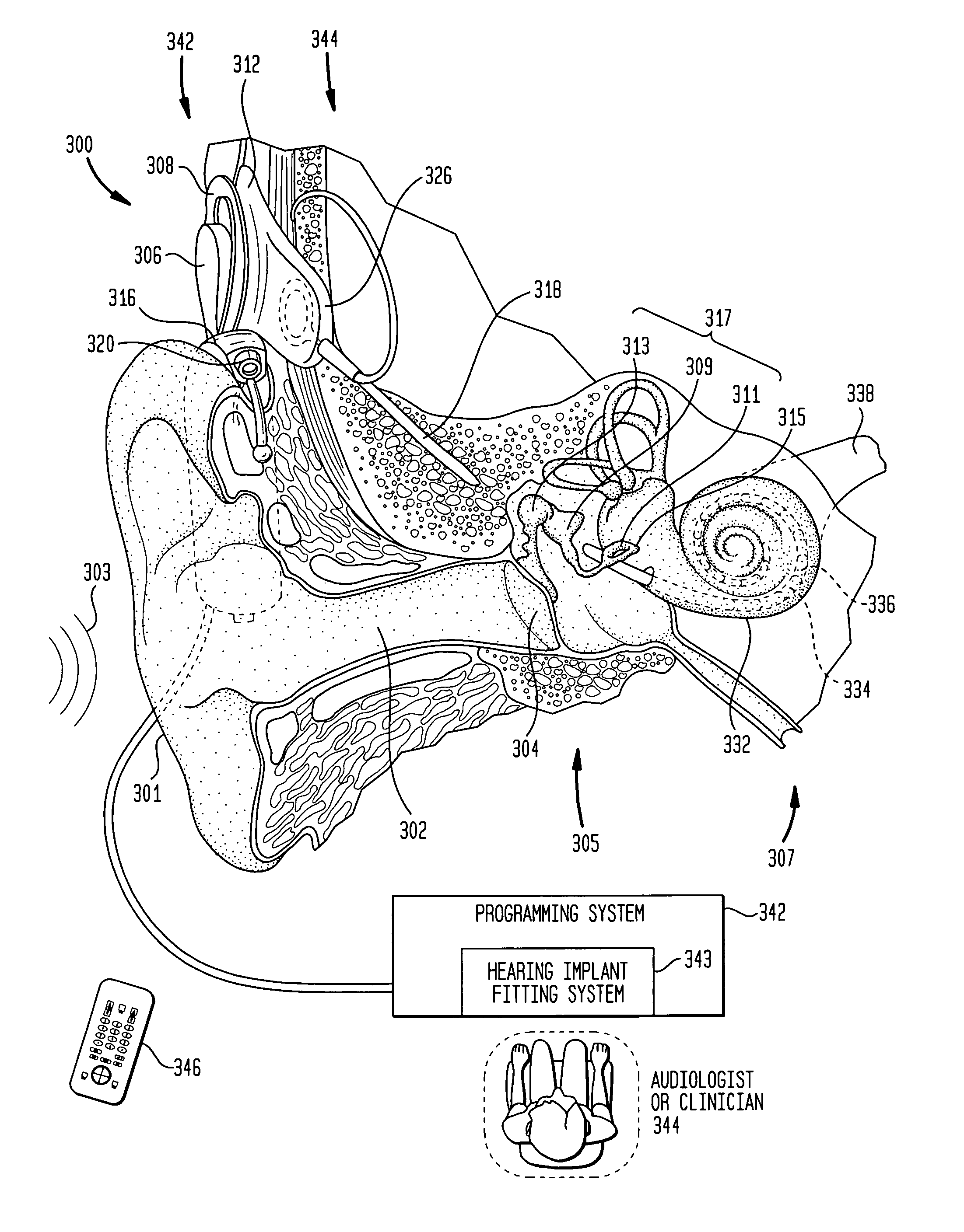 Focused stimulation in a medical stimulation device