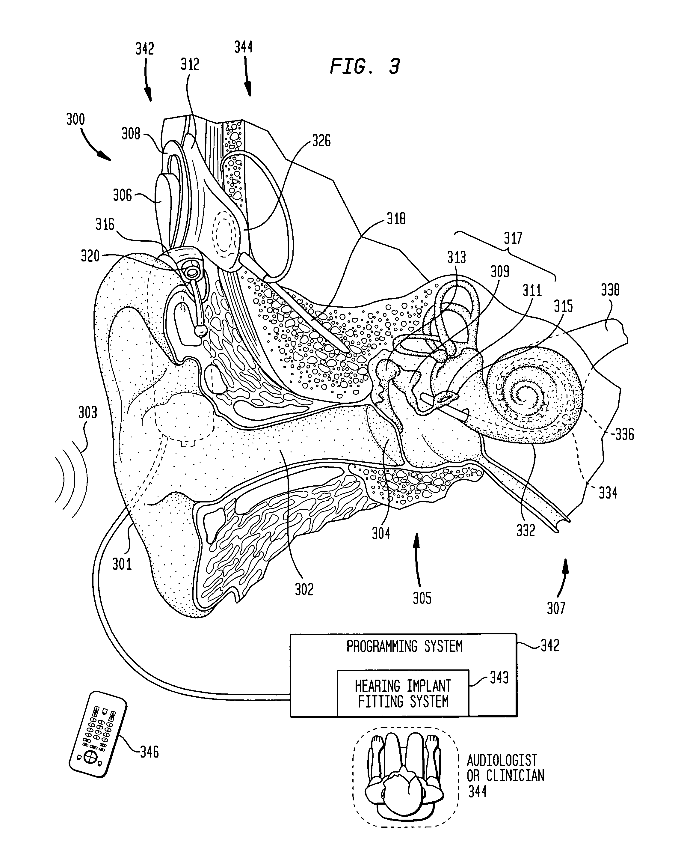 Focused stimulation in a medical stimulation device