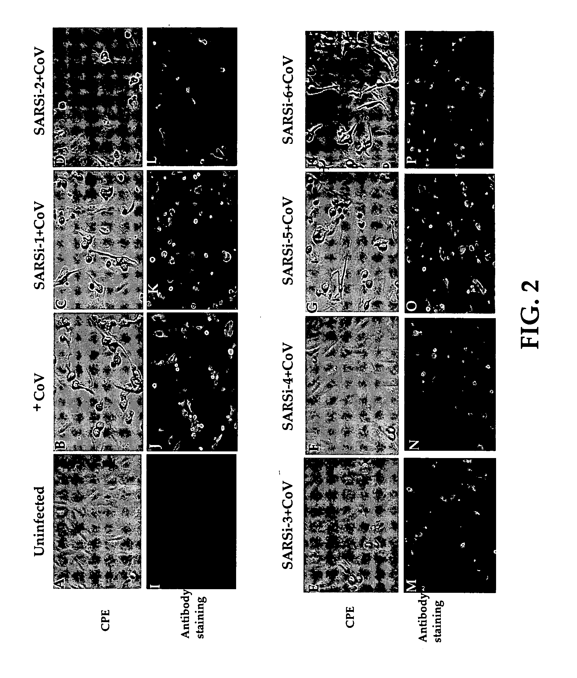 Inhibition of SARS-associated coronavirus (SCoV) infection and replication by RNA interference