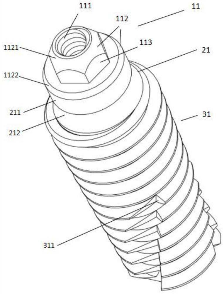 One-time implantation type composite dental implant