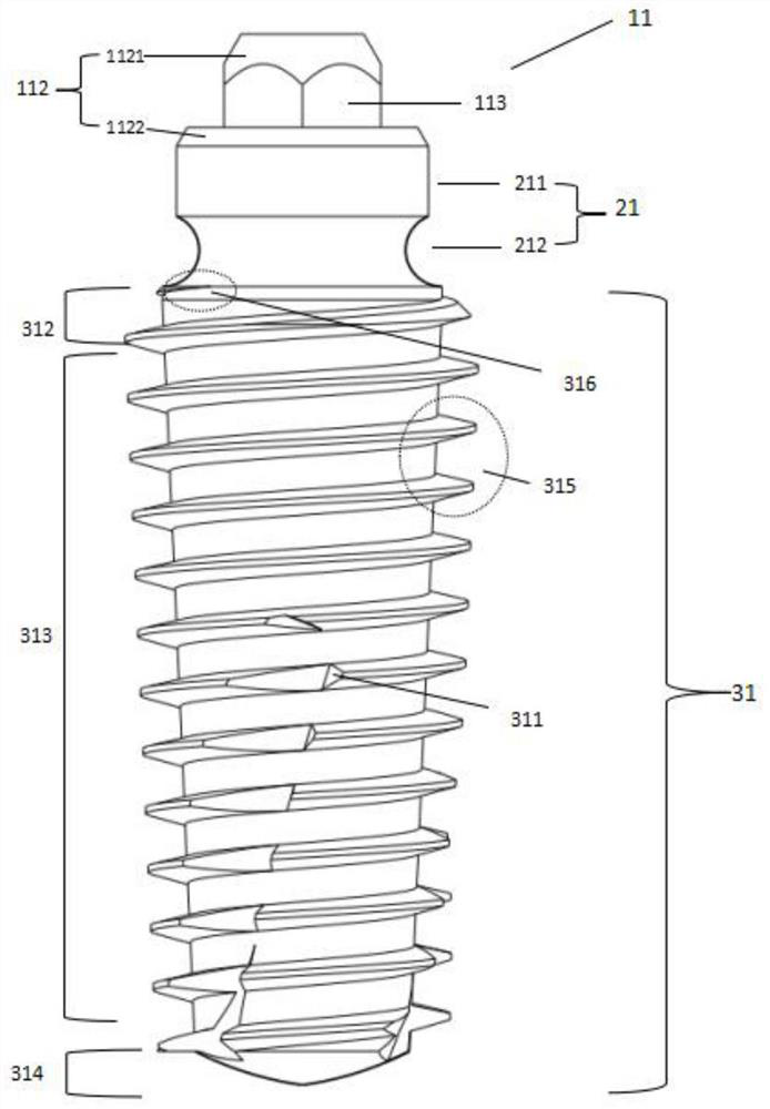 One-time implantation type composite dental implant