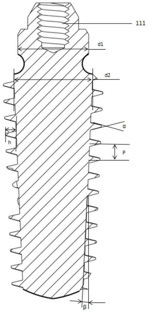 One-time implantation type composite dental implant